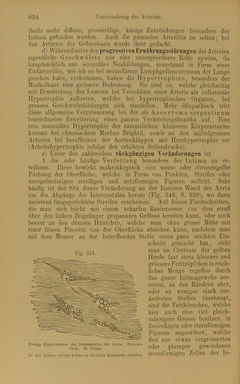 theils mehr (Muse, grosszellige, käsige Entzündungen besonders der Intima gefunden werden. Auch die gummöse Arteriitis ist selten; bei den Arterien der Gehirnbasis wurde ihrer gedacht. d) Während unter den progressiven Ernährungsstörungen der Arterien eigentliche Geschwülste nur eine untergeordnete Holle spielen, da hauptsächlich nur secundäre Neubildungen, manchmal in Form einer Endarteriitis, wie ich es bei secundärera Lymphgefässcarcinom der Lunge gesehen habe, Vorkommen, haben die Hypertrophien, besonders der Muskelhaut eine grössere Bedeutung. Sie sind es, welche gleichzeitig mit Erweiterung des Lumens bei Verschluss einer Arterie als collaterale Hypertrophie auftreten, welche bei hypertrophischen Organen, bei grossen Geschwulstbildungen sich einstellen. Mehr idiopathisch tritt diese allgemeine Vergrösserung bei der als Aneurysma Serpentin um bezeichneten Erweiterung eines ganzen Verästelungsbezirks auf. Eine rein musculäre Hypertrophie der sämmtlichen kleineren Körperarterien kommt bei chronischem Morbus Brightii, sowie an den mittelgrossen Arterien bei Insufficienz der Aortenklappen mit Herzhypertrophie vor (Arbeitshypertrophie infolge des erhöhten Seitendrucks). e) Unter den zahlreichen rückgängigen Veränderungen ist 1. die sehr häufige Verfettung besonders der Intima zu er- wähnen. Diese bewirkt makroskopisch eine weiss- oder citronengelbe Färbung der Oberfläche, welche in Form von Punkten, Streifen oder unregelmässigen streifigen und netzförmigen Figuren auftritt. Sehr häufig ist der Sitz dieser Veränderung an der hinteren Wand der Aorta um die Abgänge der lntercostales herum (Fig. 346, S. 629), wo dann meistens längsgerichtete Streifen erscheinen. Auf feinen Flachschnitten, die man sich leicht mit einem scharfen Rasirmesser von dem straff über den linken Zeigefinger gespannten Gefässe bereiten kann, oder noch besser an den dünnen Häutchen, welche man ohne grosse Mühe mit einer feinen Pincette von der Oberfläche abziehen kann, nachdem man mit dem Messer an der betreffenden Stelle einen ganz seichten Ein- schnitt gemacht hat, sieht man im Centrum der gelben Herde fast stets kleinere und grössere Fetttröpfchen in reich- licher Menge regellos durch das ganze Intimagewebe zer- streut, an den Rändern aber, oder an weniger stark ver- änderten Stellen überhaupt, sind die Fettkörnchen, welche hier auch eine viel gleich- mässigere Grösse besitzen, in dreieckigen oder sternförmigen Figuren angeordnet, welche den nur etwas vergrösserten oder plumper gewordenen sternförmigen Zellen der ln- Fig. 351. Fettige Degeneration der Intimasellen der Aorta. Frisches Präp. St. Vergr. ln den beiden oberen Zellen ist die helle Kcrnstelle sichtbar.