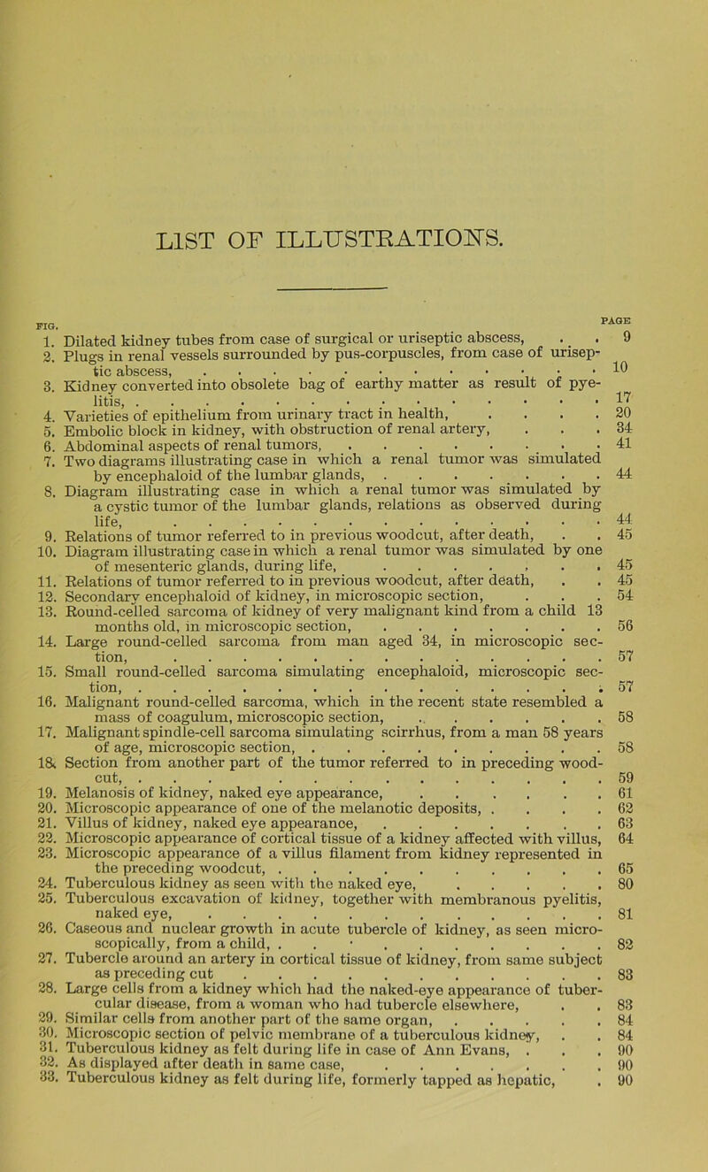 LIST OF ILLUSTRATIONS. FIG. 1. 3. 4. 5. 6. 7. 8. 9. 10. 11. 12. 13. 14. 15. 16. 17. 1& 19. 20. 21. 22. 23. 24. 25. 20. 27. 28. 29. 30. 31. 32. 33. PAGE Dilated kidney tubes from case of surgical or uriseptic abscess, Plugs in renal vessels surrounded by pus-corpuscles, from case of urisep- tic abscess, Kidney converted into obsolete bag of earthy matter as result of pye- litis, Varieties of epithelium from urinary tract in health, .... Embolic block in kidney, with obstruction of renal artery, Abdominal aspects of renal tumors . Two diagrams illustrating case in which a renal tumor was simulated by encephaloid of the lumbar glands, Diagram illustrating case in which a renal tumor was simulated by a cystic tumor of the lumbar glands, relations as observed during life, Relations of tumor referred to in previous woodcut, after death, Diagram illustrating case in which a renal tumor was simulated by one of mesenteric glands, during life, ....... Relations of tumor referred to in previous woodcut, after death, Secondary encephaloid of kidney, in microscopic section, Round-celled sarcoma of kidney of very malignant kind from a child 13 months old, in microscopic section, Large round-celled sarcoma from man aged 34, in microscopic sec- tion, Small round-celled sarcoma simulating encephaloid, microscopic sec- tion ; Malignant round-celled sarcoma, which in the recent state resembled a mass of coagulum, microscopic section, Malignant spindle-cell sarcoma simulating scirrhus, from a man 58 years of age, microscopic section, Section from another part of the tumor referred to in preceding wood- cut, ... Melanosis of kidney, naked eye appearance, Microscopic appearance of one of the melanotic deposits, .... Villus of kidney, naked eye appearance, Microscopic appearance of cortical tissue of a kidney affected with villus, Microscopic appearance of a villus filament from kidney represented in the preceding woodcut, Tuberculous kidney as seen with the naked eye, Tuberculous excavation of kidney, together with membranous pyelitis, naked eye, Caseous and nuclear growth in acute tubercle of kidney, as seen micro- scopically, from a child, . Tubercle around an artery in cortical tissue of kidney, from same subject as preceding cut Large cells from a kidney which had the naked-eye appearance of tuber- cular disease, from a woman who had tubercle elsewhere, Similar cells from another part of the same organ, Microscopic section of pelvic membrane of a tuberculous kidney, Tuberculous kidney as felt during life in case of Ann Evans, . As displayed after death in same case, Tuberculous kidney as felt during life, formerly tapped as hepatic, . 9 10 17 20 34 41 44 44 45 45 45 54 56 57 57 58 58 59 61 62 63 64 65 80 81 82 83 83 84 84 90 90 90