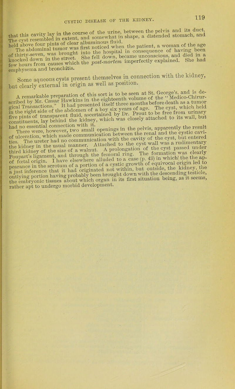 b%sr„s^ of thnty-seven, feu down, became unconscious, and died m a lTSXrnJuhS»Sh EJ& imperfectly explained. She had emphysema and bronchitis. Some aqueous cysts present themselves in connection with the kidney, hut clearly external in origin as well as position. A remarkable preparationof.tine be Menat St. 1'-sst^tfss in the right side of theffe™ SCertainecl by Dr. Prout to be free from urinary ^attached to its wall, hut had no essential ^ne^ion openings in the pelvis, apparently the result nssffl!±isrff A* sssa °oSiX^ rather apt to undergo morbid development.