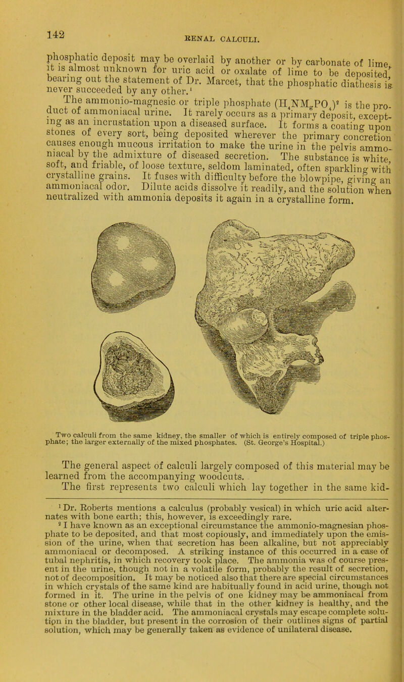 KENAL CALCULI. phosphaticI deposit may be overlaid by another or by carbonate of lime it is almost unknown tor uric acid or oxalate of lime to be deposited’ bearing out the statement of Dr. Marcet, that the phosphatic diathesis is never succeeded by any other.1 2 * * * * * The ammonio-magnesic or triple phosphate (HNM-PO,)8 is the pro- duct ot ammoniacal urine. It rarely occurs as a primary deposit, except- ing as an incrustation upon a diseased surface. It forms a coating upon stones of every sort, being deposited wherever the primary concretion causes enough mucous irritation to make the urine in the pelvis ammo- niacal by the admixture of diseased secretion. The substance is white soft, and friable, of loose texture, seldom laminated, often sparkling with crystalline grains. It fuses with difficulty before the blowpipe, giving an ammoniacal odor. Dilute acids dissolve it readily, and the solution when neutralized with ammonia deposits it again in a crystalline form. Two calculi from the same kidney, the smaller of which is entirely composed of triple phos- phate; the larger externally of the mixed phosphates. (St. George’s Hospital.) The general aspect of calculi largely composed of this material may be learned from the accompanying woodcuts. The first represents two calculi which lay together in the same kid- 1 Dr. Roberts mentions a calculus (probably vesical) in which uric acid alter- nates with bone earth; this, however, is exceedingly rare. 21 have known as an exceptional circumstance the ammonio-magnesian phos- phate to be deposited, and that most copiously, and immediately upon the emis- sion of the urine, when that secretion has been alkaline, but not appreciably ammoniacal or decomposed. A striking instance of this occurred in a case of tubal nephritis, in which recovery took place. The ammonia was of course pres- ent in the urine, though not in a volatile form, probably the result of secretion, not of decomposition. It may be noticed also that there are special circumstances in which crystals of the same kind are habitually found in acid urine, though not formed in it. The urine in the pelvis of one kidney may be ammoniacal from stone or other local disease, while that in the other kidney is healthy, and the mixture in the bladder acid. The ammoniacal crystals may escape complete solu- tion in the bladder, but present in the corrosion of their outlines signs of partial solution, which may be generally taken as evidence of unilateral disease.