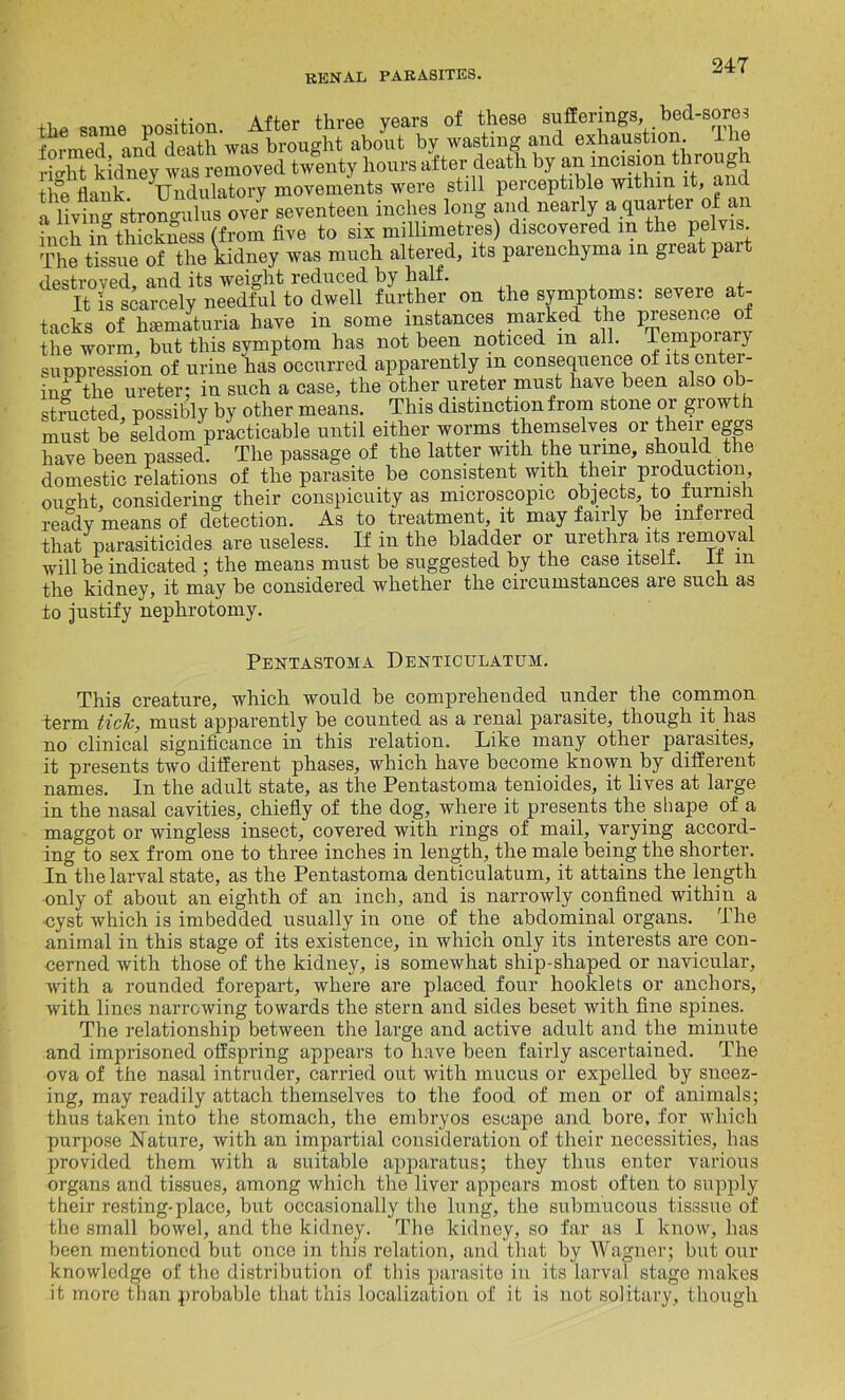 tlie same position. After three years of these sufferings bed-sores formed and death was brought about by wasting and exhaustion. Sht kidney tas removed twenty hours after death by an incision through tlfe flank Undulatory movements were still perceptible within it, and a hvin^ stronglus over seventeen inches long and nearly a quarter of an inch in thickness (from five to six millimetres) discovered in the pelvis. The tissue of the kidney was much altered, its parenchyma in great pai fland its WGisrtit rcdncGd by balf» It is scarcely needful to dwell further on the symptoms: severe at- tacks of hsematuria have in some instances marked the presence of the worm, but this symptom has not been noticed m all. Temporary suppression of urine has occurred apparently m consequence of its enter- ing the ureter; in such a case, the other ureter must have been also ob- structed, possibly by other means. This distinction from stone or growth must be seldom practicable until either worms themselves or then eggs have been passed. The passage of the latter with the urine, should the domestic relations of the parasite be consistent with their production, ought, considering their conspicuity as microscopic objects, to furnish ready means of detection. As to treatment, it may fairly be inferred that parasiticides are useless. If in the bladder or urethra its removal will be indicated ; the means must be suggested by the case itself. It m the kidney, it may be considered whether the circumstances aie such as to justify nephrotomy. Pentastoma Denticulatum. This creature, which would be comprehended under the common derm tick, must apparently be counted as a renal parasite, though it has no clinical significance in this relation. Like many other parasites, it presents two different phases, which have become known by different names. In the adult state, as the Pentastoma tenioides, it lives at large in the nasal cavities, chiefly of the dog, where it presents the shape of a maggot or wingless insect, covered with rings of mail, varying accord- ing to sex from one to three inches in length, the male being the shorter. In the larval state, as the Pentastoma denticulatum, it attains the length -only of about an eighth of an inch, and is narrowly confined within a cyst which is imbedded usually in one of the abdominal organs. The animal in this stage of its existence, in which only its interests are con- cerned with those of the kidney, is somewhat ship-shaped or navicular, with a rounded forepart, where are placed four hooklets or anchors, with lines narrowing towards the stern and sides beset with fine spines. The relationship between the large and active adult and the minute and imprisoned offspring appears to have been fairly ascertained. The ova of the nasal intruder, carried out with mucus or expelled by sneez- ing, may readily attach themselves to the food of men or of animals; thus taken into the stomach, the embryos escape and bore, for which purpose Nature, with an impartial consideration of their necessities, has provided them with a suitable apparatus; they thus enter various organs and tissues, among which the liver appears most often to supply their resting-place, but occasionally the lung, the submucous tisssue of the small bowel, and the kidney. The kidney, so far as I know, has been mentioned but once in this relation, and that by Wagner; but our knowledge of the distribution of this parasite in its larval stage makes it more than probable that this localization of it is not solitary, though