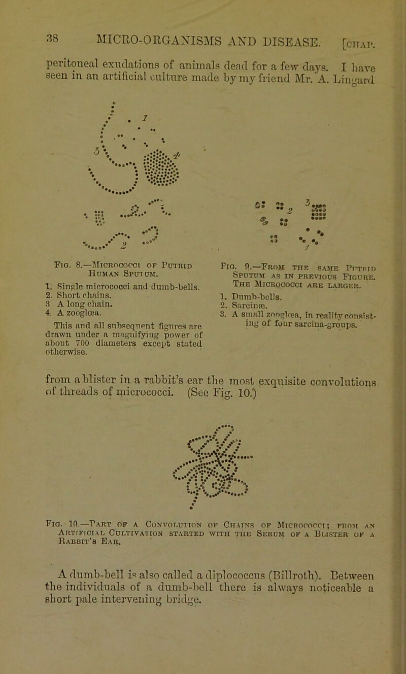 peritoneal exinlations of animals dead for a few days. I have seen in an artificial culture made by my friend Mr. A. Lingard Fio. 8.—^IiCRncorci of Putrid Human Sputum. 1. Sinsle micrococci ami dumb-bells. 2. Short chains. 3 A long chain. 4. A zoogloea. This and all subsequent figures are drawn under a nnignifying power of about 700 diameters except stated otherwise. Fio. !).—From the same Putiud Sputum .as in previous Fioure. The Micrococci are larger. 1. Dumb-bells. 2. SarciniB. 3. A small zooglnea, in reality consist- ing of four sarciua-grqups. from a blister in a rabbit’s ear the most exquisite convolutions of threads of micrococci. (See Fig. 10.) Fic. 10.—Part op a Convolution op Chains of MicRororn; from an Artificial Cultivation started with the Serum of a Duster of a Rabbit’s Ear. A dnmb-bell is also called a diplococcns (Billroth). Between the individuals of a dumb-liell there is always noticeable a short pale intervening bridge.