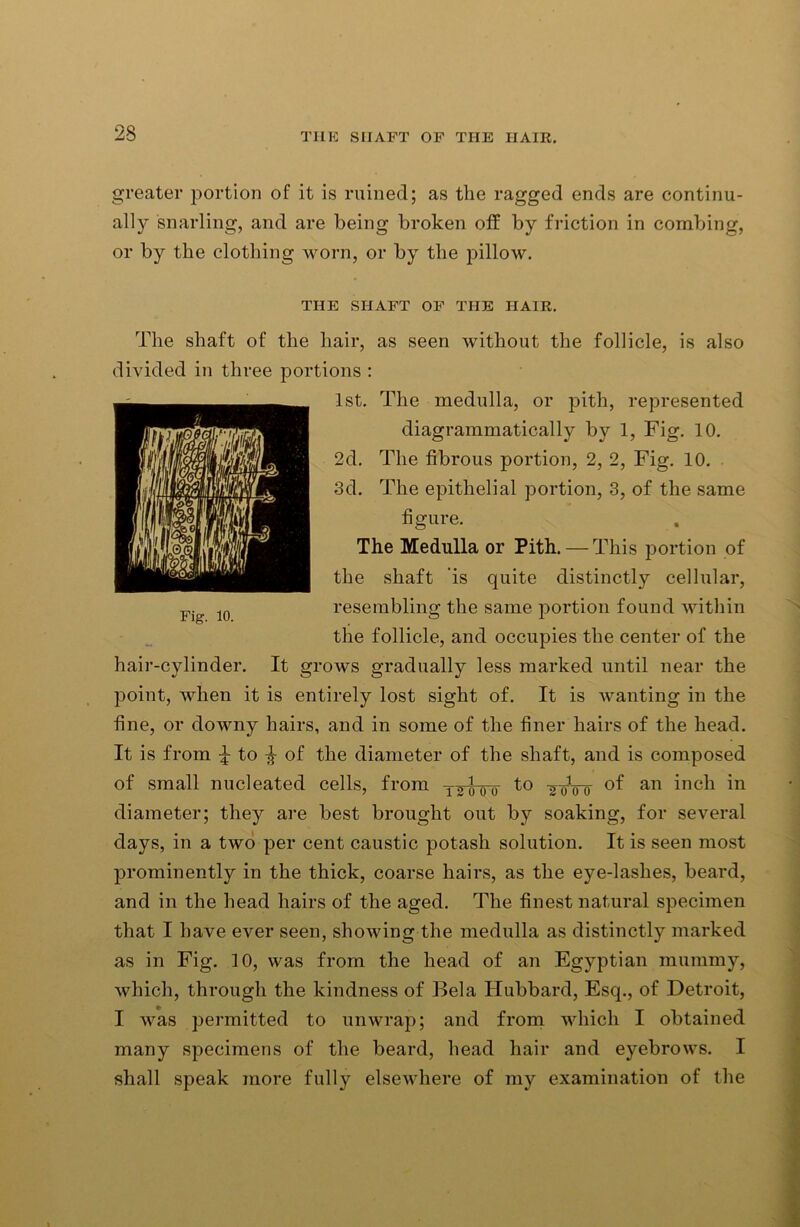 greater portion of it is ruined; as the ragged ends are continu- ally snarling, and are being broken off by friction in combing, or by the clothing worn, or by the pillow. THE SHAFT OF THE HAIR. The shaft of the hair, as seen without the follicle, is also divided in three portions : 1st. The medulla, or pith, represented diagrammatically by 1, Fig. 10. 2d. The fibrous portion, 2, 2, Fig. 10. 3d. The epithelial portion, 3, of the same figure. The Medulla or Pith. — This portion of the shaft is quite distinctly cellular, resembling the same portion found within the follicle, and occupies the center of the hair-cylinder. It grows gradually less marked until near the point, when it is entirely lost sight of. It is wanting in the fine, or downy hairs, and in some of the finer hairs of the head. It is from ^ to % of the diameter of the shaft, and is composed of small nucleated cells, from xgwo t° ToVo °f an inch in diameter; they are best brought out by soaking, for several days, in a two per cent caustic potash solution. It is seen most prominently in the thick, coarse hairs, as the eye-lashes, beard, and in the head hairs of the aged. The finest natural specimen that I have ever seen, showing the medulla as distinctly marked as in Fig. 10, was from the head of an Egyptian mummy, which, through the kindness of Bela Hubbard, Esq., of Detroit, I was permitted to unwrap; and from which I obtained many specimens of the beard, head hair and eyebrows. I shall speak more fully elsewhere of my examination of the