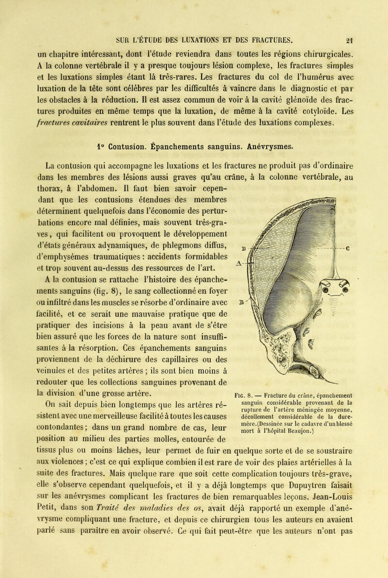 un chapitre intéressant, dont l’élude reviendra dans toutes les régions chirurgicales. A la colonne vertébrale il y a presque toujours lésion complexe, les fractures simples et les luxations simples étant là très-rares. Les fractures du col de l’humérus avec luxation de la tête sont célèbres par les difficultés à vaincre dans le diagnostic et par- les obstacles à la réduction. Il est assez commun de voir à la cavité glénoïde des frac- tures produites en même temps que la luxation, de même à la cavité cotyloïde. Les fractures cavitaires rentrent le plus souvent dans l’étude des luxations complexes. 1° Contusion. Épanchements sanguins. Anévrysmes. La contusion qui accompagne les luxations et les fractures ne produit pas d’ordinaire dans les membres des lésions aussi graves qu’au crâne, à la colonne vertébrale, au thorax, à l’abdomen. Il faut bien savoir cepen- dant que les contusions étendues des membres déterminent quelquefois dans l’économie des pertur- bations encore mal définies, mais souvent très-gra- ves , qui facilitent ou provoquent le développement d’états généraux advnamiques, de phlegmons diffus, d’emphysèmes traumatiques : accidents formidables et trop souvent au-dessus des ressources de l’art. A la contusion se rattache l’histoire des épanche- ments sanguins (fig. 8), le sang collectionné en foyer ou infiltré dans les muscles se résorbe d’ordinaire avec facilité, et ce serait une mauvaise pratique que de pratiquer des incisions à la peau avant de s’être bien assuré que les forces de la nature sont insuffi- santes à la résorption. Ces épanchements sanguins proviennent de la déchirure des capillaires ou des veinules et des petites artères ; ils sont bien moins à redouter que les collections sanguines provenant de la division d’une grosse artère. On sait depuis bien longtemps que les artères ré- sistent avec une merveilleuse facilité à toutes les causes contondantes ; dans un grand nombre de cas, leur position au milieu des parties molles, entourée de tissus plus ou moins lâches, leur permet de fuir en quelque sorte et de se soustraire aux violences ; c’est ce qui explique combien il est rare de voir des plaies artérielles à la suite des fractures. Mais quelque rare que soit cette complication toujours très-grave, elle s’observe cependant quelquefois, et il y a déjà longtemps que Dupuytren faisait sur les anévrysmes complicant les fractures de bien remarquables leçons. Jean-Louis Petit, dans son Traité des maladies des os, avait déjà rapporté un exemple d’ané- vrysme compliquant une fracture, et depuis ce chirurgien tous les auteurs en avaient parlé sans paraître en avoir observé. Ce qui fait peut-être que les auteurs n’ont pas Fig. 8. — Fracture du crâne, épanchement sanguin considérable provenant de la rupture de l’artère méningée moyenne, décollement considérable de la dure- mère.(Dessinée sur le cadavre d’unblessé mort à l’hôpital Beaujon.)
