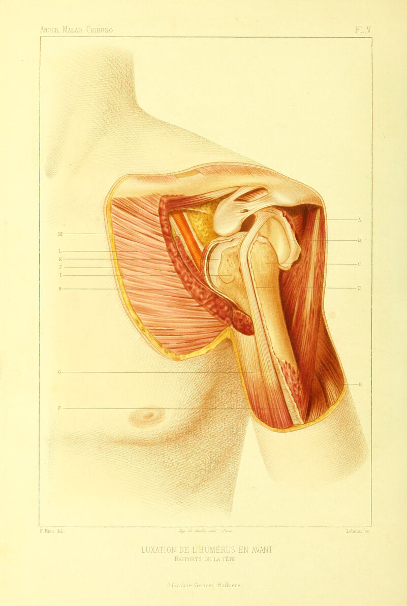 LUXATION DE L'HUMÉRUS EN AVANT Rapports de la tète Librairie Germer BaiUïere .