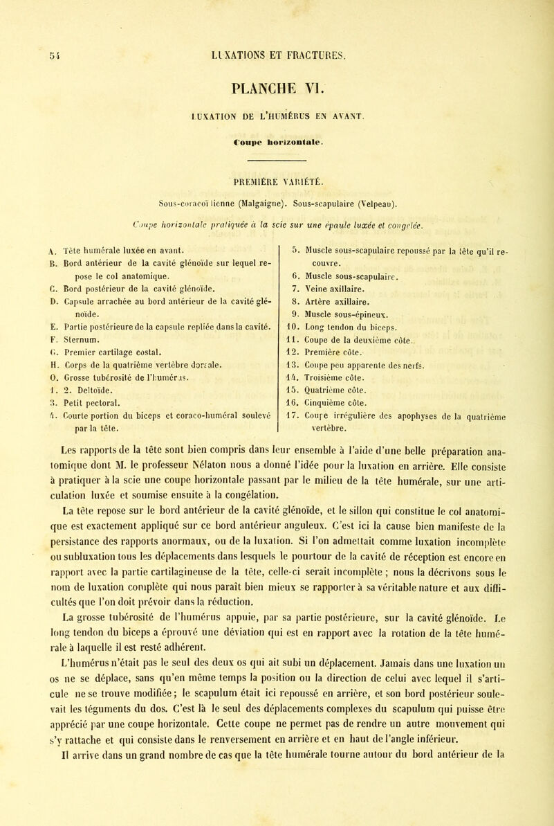 PLANCHE VI. LUXATION DE L’HUMÉRUS EN AVANT. Coupe horizontale. PREMIÈRE VARIÉTÉ. Sous-coi acoï lienne (Malgaigne). Sous-scapulaire (Velpeau). Coupe horizontale pratiquée à la scie sur une épaule luxée et congelée. A. Tète humérale luxée en avant. R. Bord antérieur de la cavité glénoïde sur lequel re- pose le col anatomique. C. Bord postérieur de la cavité glénoïde. D. Capsule arrachée au bord antérieur de la cavité glé- noïde. E. Partie postérieure de la capsule repliée dans la cavité. F. Sternum. G. Premier cartilage costal. H. Corps de la quatrième vertèbre dorsale. 0. Grosse tubérosité de l’humcr.is. I. 2. Deltoïde. R. Petit pectoral. A. Courte portion du biceps et coraco-huméral soulevé par la tête. 5. Muscle sous-scapulaire repoussé par la tête qu’il re- couvre. 6. Muscle sous-scapulaire. 7. Veine axillaire. 8. Artère axillaire. 9. Muscle sous-épineux. 10. Long tendon du biceps. 11. Coupe de la deuxième côte. 12. Première côte. 13. Coupe peu apparente des nerfs. IA. Troisième côte. 15. Quatrième côte. 16. Cinquième côte. 17. Coupe irrégulière des apophyses de la quatrième vertèbre. Les rapports de la tête sont bien compris dans leur ensemble à l’aide d’une belle préparation ana- lomique dont M. le professeur Nélaton nous a donné l’idée pour la luxation en arrière. Elle consiste à pratiquer à la scie une coupe horizontale passant par le milieu de la tête humérale, sur une arti- culation luxée et soumise ensuite à la congélation. La tête repose sur le bord antérieur de la cavité glénoïde, et le sillon qui constitue le col anatomi- que est exactement appliqué sur ce bord antérieur anguleux. C’est ici la cause bien manifeste de la persistance des rapports anormaux, ou de la luxation. Si l’on admettait comme luxation incomplète ou subluxation tous les déplacements dans lesquels le pourtour de la cavité de réception est encore en rapport avec la partie cartilagineuse de la tête, celle-ci serait incomplète ; nous la décrivons sous le nom de luxation complète qui nous paraît bien mieux se rapportera sa véritable nature et aux diffi- cultés que l’on doit prévoir dans la réduction. La grosse tubérosité de l’humérus appuie, par sa partie postérieure, sur la cavité glénoïde. Le long tendon du biceps a éprouvé une déviation qui est en rapport avec la rotation de la tête humé- rale à laquelle il est resté adhérent. L’humérus n’était pas le seul des deux os qui ait subi un déplacement. Jamais dans une luxation un os ne se déplace, sans qu’en même temps la position ou la direction de celui avec lequel il s’arti- cule ne se trouve modifiée ; le scapulum était ici repoussé en arrière, et son bord postérieur soule- vait les téguments du dos. C’est là le seul des déplacements complexes du scapulum qui puisse être apprécié par une coupe horizontale. Cette coupe ne permet pas de rendre un autre mouvement qui s’y rattache et qui consiste dans le renversement en arrière et en haut de l’angle inférieur. Il arrive dans un grand nombre de cas que la tête humérale tourne autour du bord antérieur de la