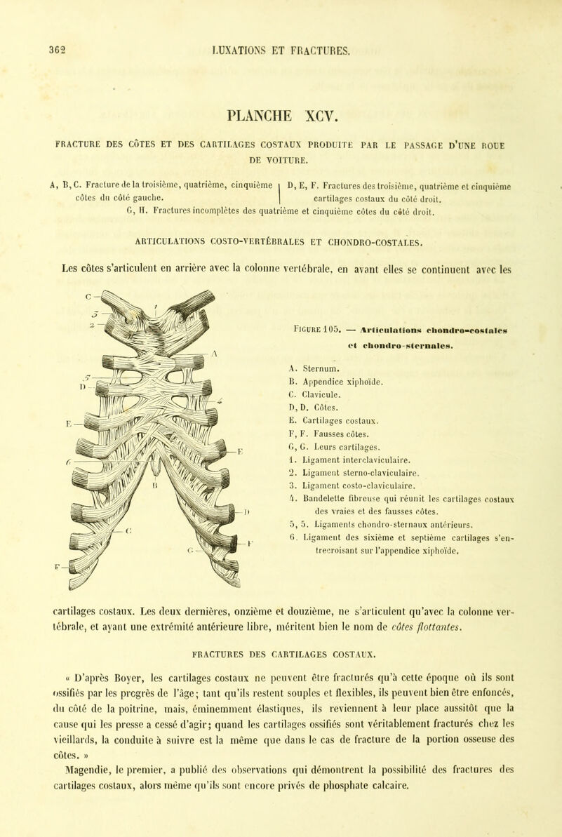 PLANCHE XCV. FRACTURE DES CÔTES ET DES CARTILAGES COSTAUX PRODUITE PAR I.E PASSAGE D’UNE ROUE DE VOITURE. A, B,C. Fracture de la troisième, quatrième, cinquième i D, E, F. Fractures des troisième, quatrième et cinquième côtes du côté gauche. | cartilages costaux du côté droit. G, H. Fractures incomplètes des quatrième et cinquième côtes du cité droit. ARTICULATIONS COSTO-VERTÉBRALES ET CHONDRO-COSTAI.ES. Les côtes s’articulent en arrière avec la colonne vertébrale, en avant elles se continuent avec les Figure 105. — Articulations cbondro-costales et cbomlro-sternales. A. Sternum. B. Appendice xiphoïde. C. Clavicule. D. D. Côtes. E. Cartilages costaux. F. F. Fausses côtes. G. G. Leurs cartilages. 1. Ligament interclaviculaire. 2. Ligament sterno-claviculaire. 3. Ligament costo-claviculaire. 'i. Bandelette fibreuse qui réunit les cartilages costaux des vraies et des fausses côtes. 5, 5. Ligaments chondro-sternaux antérieurs. G. Ligament des sixième et septième cartilages s’en- trecroisant sur l’appendice xiphoïde. cartilages costaux. Les deux dernières, onzième et douzième, ne s’articulent qu’avec la colonne ver- tébrale, et ayant une extrémité antérieure libre, méritent bien le nom de côtes flottantes. FRACTURES DES CARTILAGES COSTAUX. « D’après Boyer, les cartilages costaux ne peuvent être fracturés qu’à cette époque où ils sont ossifiés parles progrès de l’âge; tant qu’ils restent souples et flexibles, ils peuvent bien être enfoncés, du côté de la poitrine, mais, éminemment élastiques, ils reviennent à leur place aussitôt que la cause qui les presse a cessé d’agir; quand les cartilages ossifiés sont véritablement fracturés chez les vieillards, la conduite à suivre est la même que dans le cas de fracture de la portion osseuse des côtes. » Magendie, le premier, a publié des observations qui démontrent la possibilité des fractures des cartilages costaux, alors même qu’ils sont encore privés de phosphate calcaire.