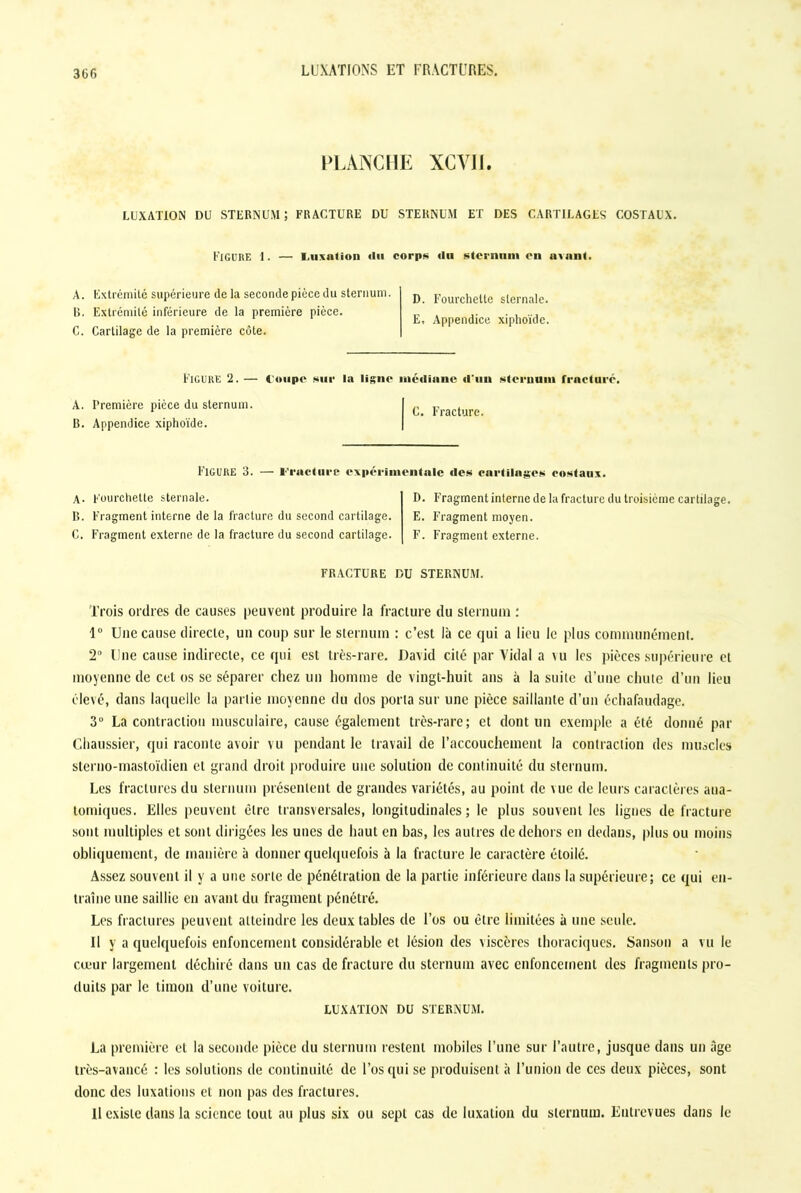 PLANCHE XCVII. LUXATION DU STERNUM; FRACTURE DU STERNUM ET DES CARTILAGES COSTAUX. Figure i. — Luxation «lu corps «lu sternum en avant. A. Extrémité supérieure de la seconde pièce du sternum. B. Extrémité inférieure de la première pièce. C. Cartilage de la première côte. D. Fourchette sternale. E, Appendice xiphoïde. Figure !2. — loupe sur la ligne médiane d'un sternum fracturé. A. Première pièce du sternum. B. Appendice xiphoïde. C. Fracture. FIGURE 3. — l’raelurc expérimentale des eartilaaes costaux. A. Fourchette sternale. B. Fragment interne de la fracture du second cartilage. C. Fragment externe de la fracture du second cartilage. D. Fragment interne de la fracture du troisième cartilage. E. Fragment moyen. F. Fragment externe. FRACTURE DU STERNUM. Trois ordres de causes peuvent produire la fracture du sternum : 1° Une cause directe, un coup sur le sternum : c’est là ce qui a lieu le plus communément. 2° Une cause indirecte, ce qui est très-rare. David cité par Vidal a \u les pièces supérieure et moyenne de cet os se séparer citez un homme de vingt-huit ans à la suite d’une chute d’un lieu élevé, dans laquelle la partie moyenne du dos porta sur une pièce saillante d’un échafaudage. 3° La contraction musculaire, cause également très-rare; et dont un exemple a été donné par (.haussier, qui raconte avoir vu pendant le travail de l’accouchement la conlraction des muscles sterno-mastoïdien et grand droit produire une solution de continuité du sternum. Les fractures du sternum présentent de grandes variétés, au point de \ue de leurs caractères aua- tomiques. Elles peuvent être transversales, longitudinales; le plus souvent les lignes de fracture sont multiples et sont dirigées les unes de haut en bas, les autres de dehors en dedans, plus ou moins obliquement, de manière à donner quelquefois à la fracture le caractère étoilé. Assez souvent il y a une sorte de pénétration de la partie inférieure dans la supérieure; ce qui en- traîne une saillie en avant du fragment pénétré. Les fractures peuvent atteindre les deux tables de l’os ou être limitées à une seule. U y a quelquefois enfoncement considérable et lésion des viscères thoraciques. Sanson a vu le coeur largement déchiré dans un cas de fracture du sternum avec enfoncement des fragments pro- duits par le timon d’une voiture. LUXATION DU STERNUM. La première et la seconde pièce du sternum restent mobiles l’une sur l’autre, jusque dans un âge très-avancé : les solutions de continuité de l’os qui se produisent à l’union de ces deux pièces, sont donc des luxations et non pas des fractures. Il existe dans la science tout au plus six ou sept cas de luxation du sternum. Entrevues dans le