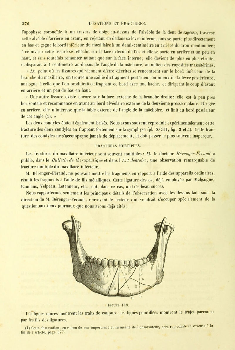 l’apophyse coronoïde, à un travers de doigt au-dessus de l’alvéole de la dent de sagesse, traverse cette alvéole d’arrière en avant, en rejetant en dedans sa lèvre interne, puis se porte plus directement en bas et gagne le bord inférieur du maxillaire à un demi-centimètre en arrière du trou mentonnier; à ce niveau celte fissure se réfléchit sur la face externe de l’os et elle se porte en arrière et un peu en haut, et sans toutefois remonter autant que sur la face interne; elle devient de plus en plus étroite, et disparaît à 1 centimètre au-dessus de l’angle de la mâchoire, au milieu des rugosités massétérines. « Au point où les fissures qui viennent d’être décrites se rencontrent sur le bord inférieur de la branche du maxillaire, on trouve une saillie du fragment postérieur ou mieux de la lèvre postérieure, analogue à celle que l’on produirait en frappant ce bord avec une hache, et dirigeant le coup d’avant en arrière et un peu de bas en haut. » Une autre fissure existe encore sur la face externe delà branche droite; elle est à peu près horizontale et recommence en avant au bord alvéolaire externe de la deuxième grosse molaire. Dirigée en arrière, elle n’intéresse que la table externe de l’angle de la mâchoire, et finit au bord postérieur de cet angle (1). » Les deuxeondyles étaient également brisés. Nous avons souvent reproduit expérimentalement cette fracture des deux condyles en frappant fortement sur la symphyse (pl. XCIII, fig. 3 et A). Cette frac- ture des condyles ne s’accompagne jamais de déplacement, et doit passer le plus souvent inaperçue. FRACTURES MULTIPLES. Les fractures du maxillaire inférieur sont souvent multiples : M. le docteur Bérenger-Féraud a publié, dans le Bulletin de thérapeutique et dans l'Art dentaire, une observation remarquable de fracture multiple du maxillaire inférieur. M. Bérenger-Féraud, ne pouvant mettre les fragments en rapport à l’aide des appareils ordinaires, réunit les fragments à l’aide de fils métalliques. Cette ligature des os, déjà employée par Malgaigne, Baudens, Velpeau, Letenneur, etc., eut, dans ce cas, un très-beau succès. Nous rapporterons seulement les principaux détails de l’observation avec les dessins faits sous la direction de M. Bérenger-Féraud , renvoyant le lecteur qui voudrait s’occuper spécialement de la question aux deux journaux que nous avons déjà cités : Figure 108. Les*] ignés noires montrent les traits de coupure, les lignes pointillees montrent le tiajet paicouiu par les fils des ligatures. (1) Cette observation, en raison de son importance et du mérite de l’observateur, sera reproduite in extenso à la fin de l’article, page 377.