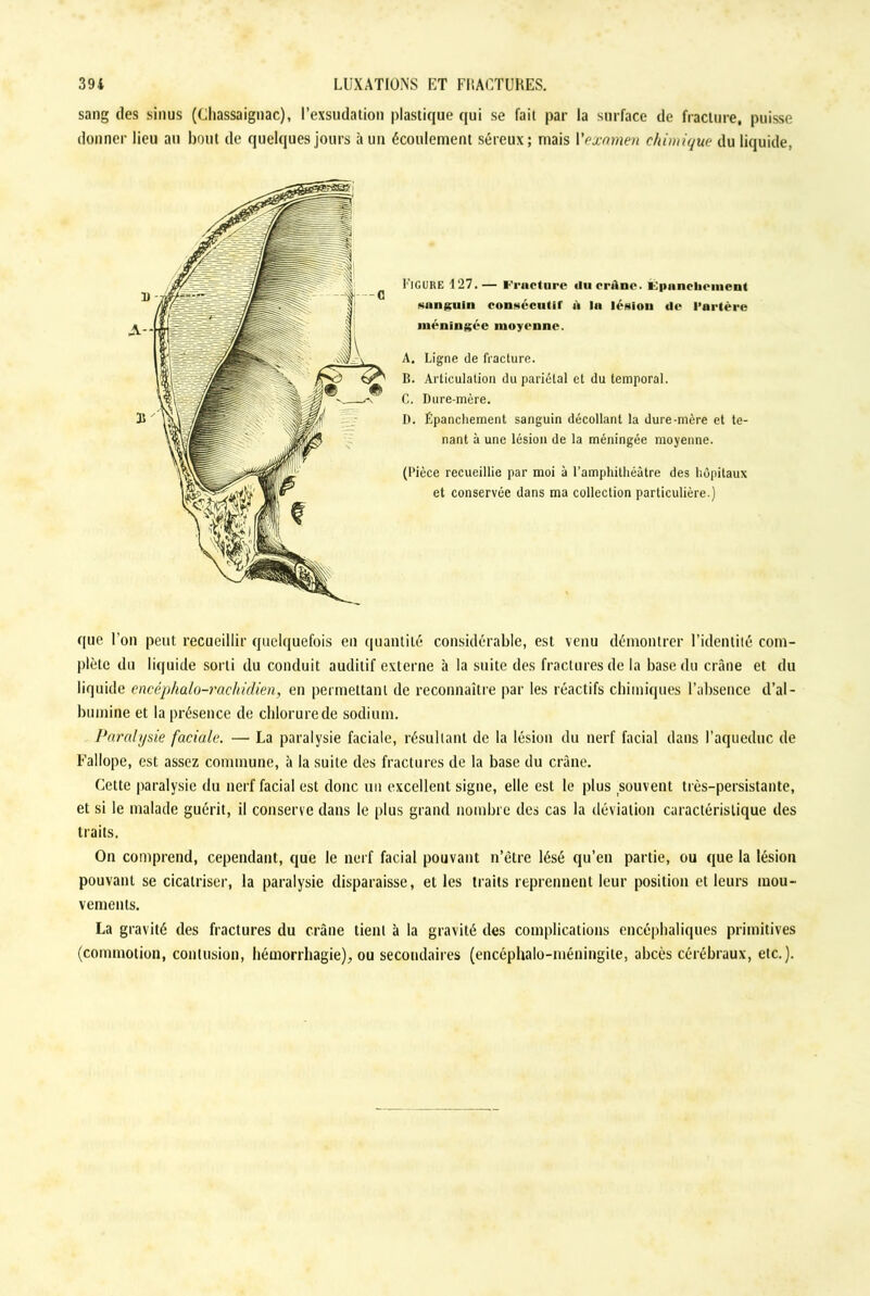 sang des sinus (Chassaignac), l’exsudation plastique qui se fait par la surface de fracture, puisse donner lieu au bout de quelques jours à un écoulement séreux; mais l'examen chimique- du liquide, Figure 127.— l‘'i'aeture «lucrAnc. i-:pnnclicnteii( sanguin consécutif A In lésion de l’artère méningée moyenne. A. Ligne de fracture. B. Articulation du pariétal et du temporal. C. Dure-mère. I). Épanchement sanguin décollant la dure-mère et te- nant à une lésion de la méningée moyenne. (Pièce recueillie par moi à l’amphithéâtre des hôpitaux et conservée dans ma collection particulière.) que l’on peut recueillir quelquefois en quantité considérable, est venu démontrer l’identité com- plète du liquide sorti du conduit auditif externe à la suite des fractures de la base du crâne et du liquide encéphalo-rachidien, en permettant de reconnaître par les réactifs chimiques l’absence d’al- bumine et la présence de chlorure de sodium. Paralysie faciale. — La paralysie faciale, résultant de la lésion du nerf facial dans l’aqueduc de Fallope, est assez commune, à la suite des fractures de la base du crâne. Cette paralysie du nerf facial est donc un excellent signe, elle est le plus souvent très-persistante, et si le malade guérit, il conserve dans le plus grand nombre des cas la déviation caractéristique des traits. On comprend, cependant, que le nerf facial pouvant n’être lésé qu’en partie, ou que la lésion pouvant se cicatriser, la paralysie disparaisse, et les traits reprennent leur position et leurs mou- vements. La gravité des fractures du crâne tient à la gravité des complications encéphaliques primitives (commotion, contusion, hémorrhagie), ou secondaires (encéphalo-méningite, abcès cérébraux, etc.).