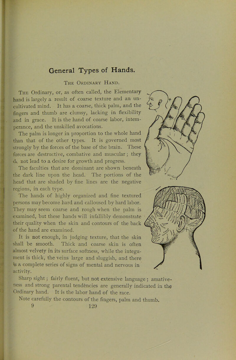 i' ffi >a :> General Types of Hands. The Ordinary Hand. The Ordinary, or, as often called, the Elementary hand is largely a result of coarse texture and an un- cultivated mind. It has a coarse, thick palm, and the fingers and thumb are clumsy, lacking in flexibility and in grace. It is the hand of coarse labor, intem- perance, and the unskilled avocations. The palm is longer in proportion to the whole hand than that of the other types. It is governed most strongly by the forces of the base of the brain. These forces are destructive, combative and muscular j they dv not lead to a desire for growth and progress. The faculties that are dominant are shown beneath the dark line upon the head. The portions of the head that are shaded by fine lines are the negative regions, in each type. The hands of highly organized and fine textured persons may become hard and calloused by hard labor. They may seem coarse and rough when the palm is examined, but these hands will infallibly demonstrate their quality when the skin and contours of the back of the hand are examined. It is not enough, in judging texture, that the skin shall be smooth. Thick and coarse skin is often almost velvety in its surface softness, while the integu- ment is thick, the veins large and sluggish, and there i-s a complete series of signs of mental and nervous in activity. Sharp sight; fairly fluent, but not extensive language ; amative- ness and strong parental tendencies are generally indicated in the Ordinary hand. It is the labor hand of the race. Note carefully the contours of the fingers, palm and thumb. J /CMIJS**