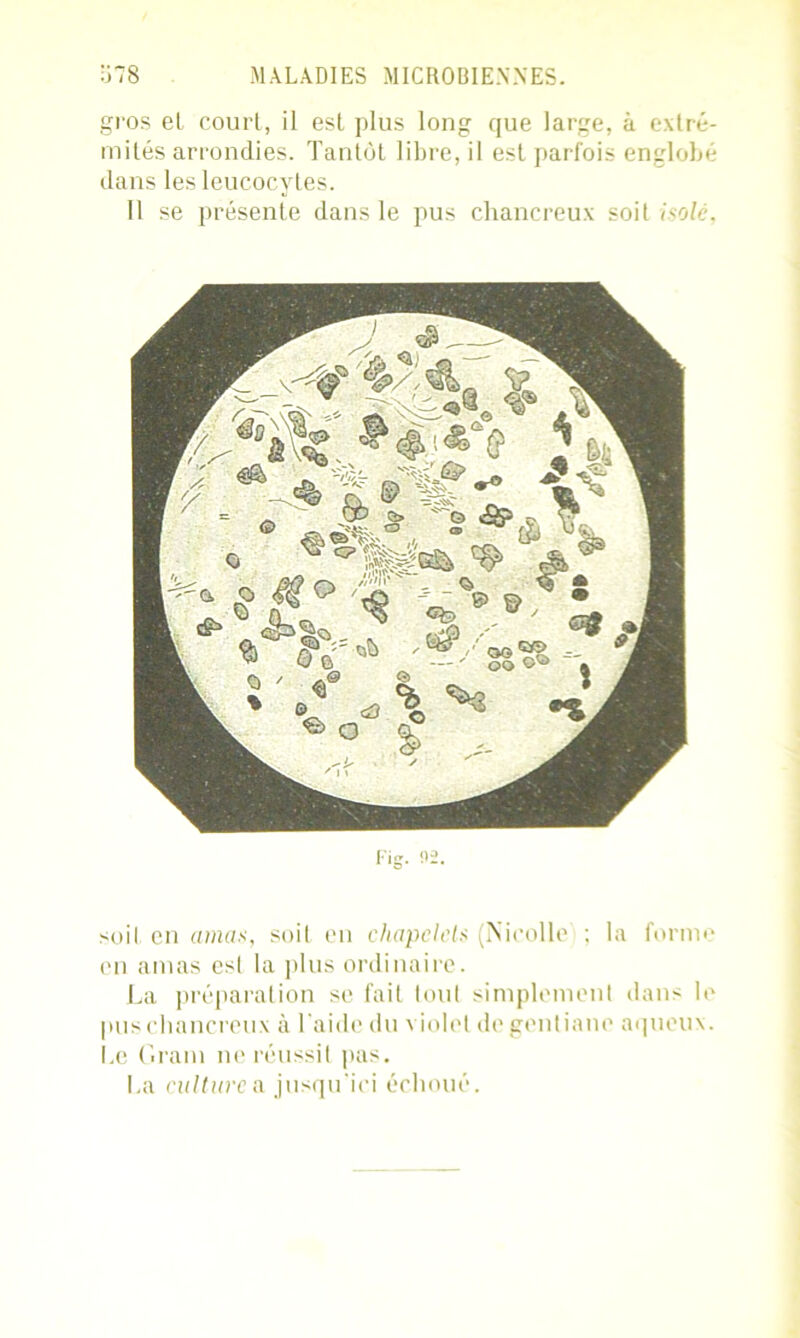 gros et court, il est plus long que large, à extré- mités arrondies. Tantôt libre, il est parfois englobé dans les leucocytes. 11 se présente dans le pus chancreux soit isole. soit en amas, soit en chapelets (Nicolle ; la forme en amas est la plus ordinaire. La préparation se fait tout simplement dans le pus chancreux à l'aide du violet de gentiane aqueux. Le Gram ne réussit pas. La culture a jusqu'ici échoué.