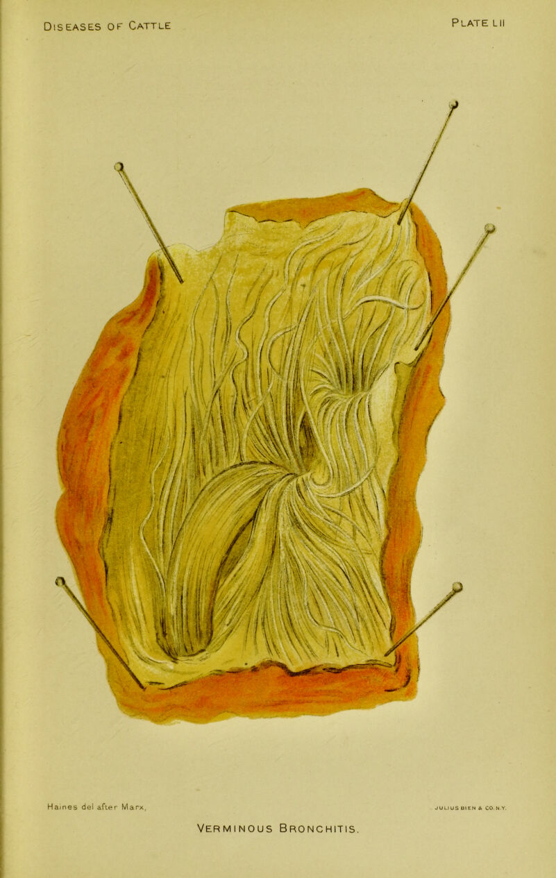 Plate hi Haines del after Marx, JULIUS BIEN & CO.N Y. Verminous Bronchitis.