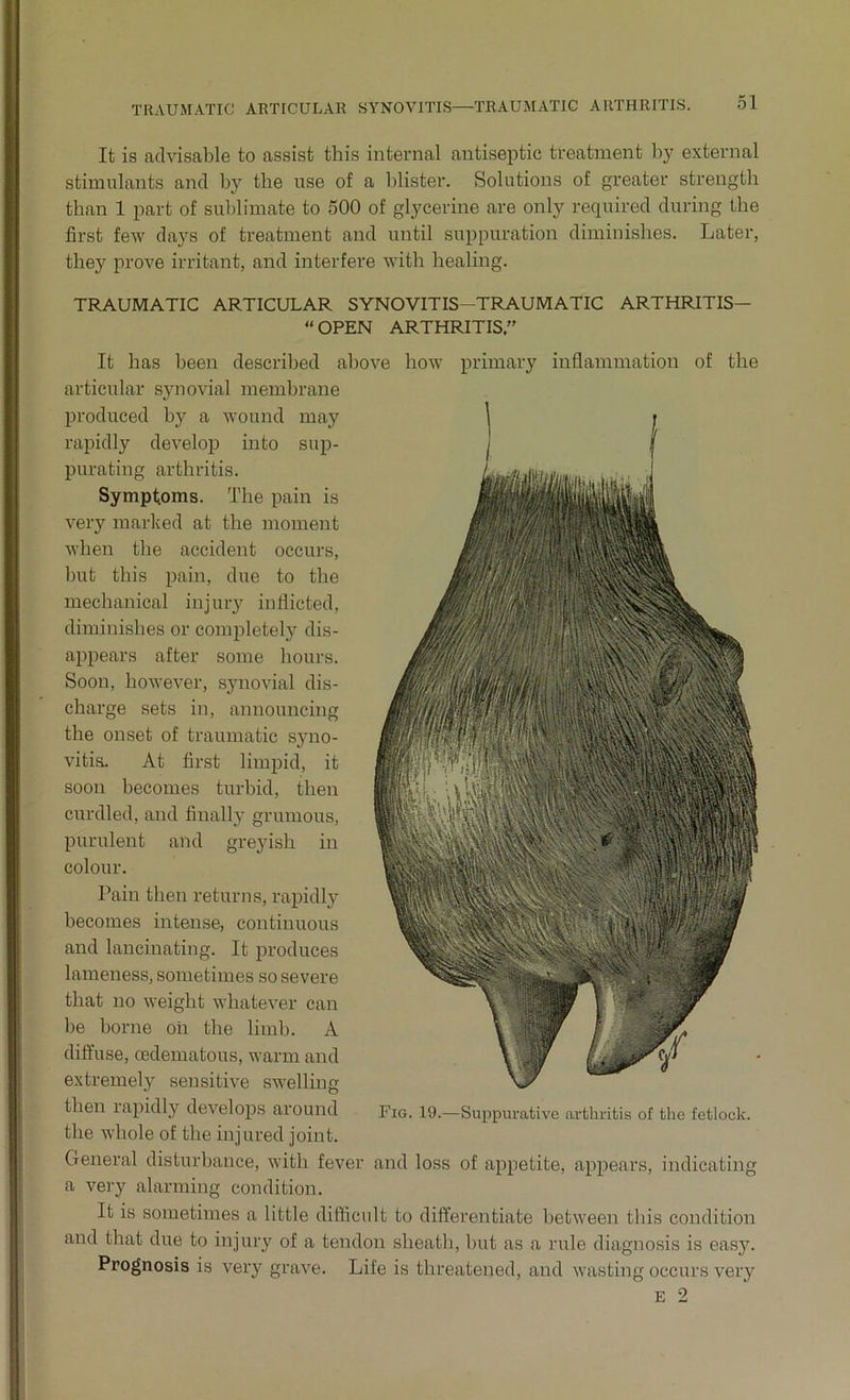 TRAUMATIC ARTICULAR SYNOVITIS—TRAUMATIC ARTHRITIS. It is advisable to assist this internal antiseptic treatment by external stimulants and by the use of a blister. Solutions of greater strength than 1 part of sublimate to 500 of glycerine are only required during the first few days of treatment and until suppuration diminishes. Later, they prove irritant, and interfere with healing. TRAUMATIC ARTICULAR SYNOVITIS-TRAUMATIC ARTHRITIS— “OPEN ARTHRITIS” It has been described above how primary inflammation of the articular synovial membrane produced by a wound may rapidly develop into sup- purating arthritis. Symptoms. The pain is very marked at the moment when the accident occurs, but this pain, due to the mechanical injury inflicted, diminishes or completely dis- appears after some hours. Soon, however, synovial dis- charge sets in, announcing the onset of traumatic syno- vitis. At first limpid, it soon becomes turbid, then curdled, and finally grumous, purulent and greyish in colour. Pain then returns, rapidly becomes intense, continuous and lancinating. It produces lameness, sometimes so severe that no weight whatever can be borne oh the limb. A diffuse, cedematous, warm and extremely sensitive swelling then rapidly develops around Fig. 19.—Suppurative arthritis of the fetlock, the whole of the injured joint. General disturbance, with fever and loss of appetite, appears, indicating a very alarming condition. It is sometimes a little difficult to differentiate between this condition and that due to injury of a tendon sheath, but as a rule diagnosis is easy. Prognosis is very grave. Life is threatened, and wasting occurs very