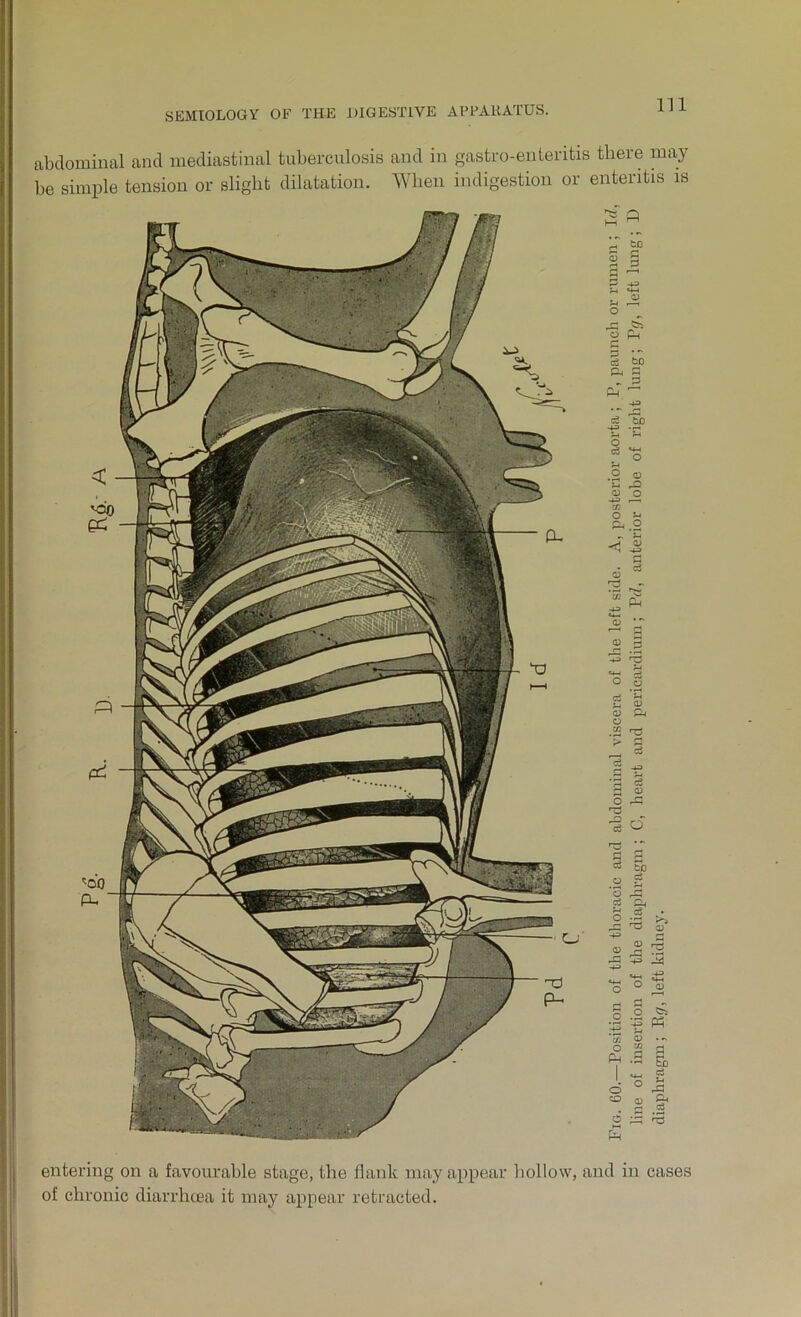 abdominal and mediastinal tuberculosis and in gastro-enteritis there may be simple tension or slight dilatation. When indigestion or enteritis is P 43 *P o Ph c3 to Pa P „ P O c3 .2 © -*3 O Q <3* © .2 © -+3 a c3 O cj © o o •8 0 'g g ® bO © $ *© rD ci d, ^ c3 0 -rp rZ, Tj >-S © 43 © © rP -43 43 e*-l 'S 0 43 «4H © rn C £ O O • r—« '43 -g 'cfl © Ph 0 g .a So i ° a u rP CD CD Pa .2 2 ^ ^3 entering on a favourable stage, the flank may appear hollow, and in cases of chronic diarrhoea it may appear retracted.
