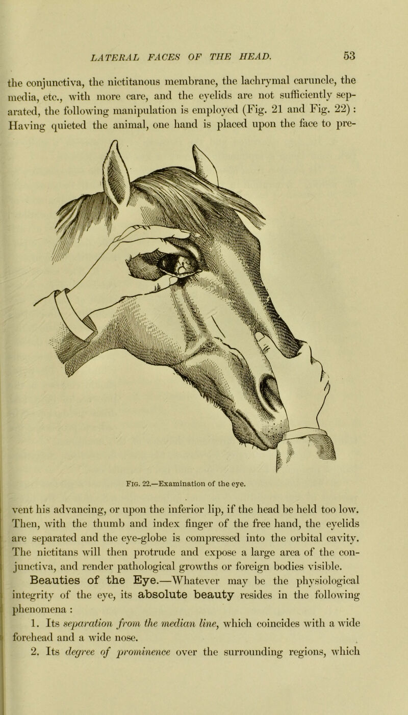 the conjunctiva, the nictitanous membrane, the lachrymal caruncle, the media, etc., with more care, and the eyelids are not sufficiently sep- arated, the following manipulation is employed (Fig. 21 and Fig. 22) : Having quieted the animal, one hand is placed upon the face to pre- Fig. 22.—Examination of the eye. vent his advancing, or upon the inferior lip, if the head be held too low. Then, with the thumb and index finger of the free hand, the eyelids are separated and the eye-globe is eompressed into the orbital cavity. The nictitans will then protrude and expose a large area of the con- junctiva, and render pathological growths or foreign bodies visible. Beauties of the Eye.—Whatever may be the physiological integrity of the eye, its absolute beauty résides in the following phenomena : 1. Its séparation front the médian line, which coincides with a wide forehead and a wide nose. 2. Its degree of prominence over the surrounding régions, which