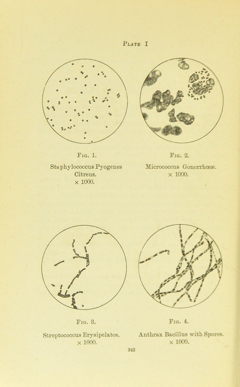 Plate I PlG. 2. Staphylococcus Pyogenes Citreus. X 1000. Micrococcus Gonorrhoeae. X 1000. Streptococcus Erysipelatos. X lOOO. Aiitlu-ax Bacillus with Spores. X 1000.