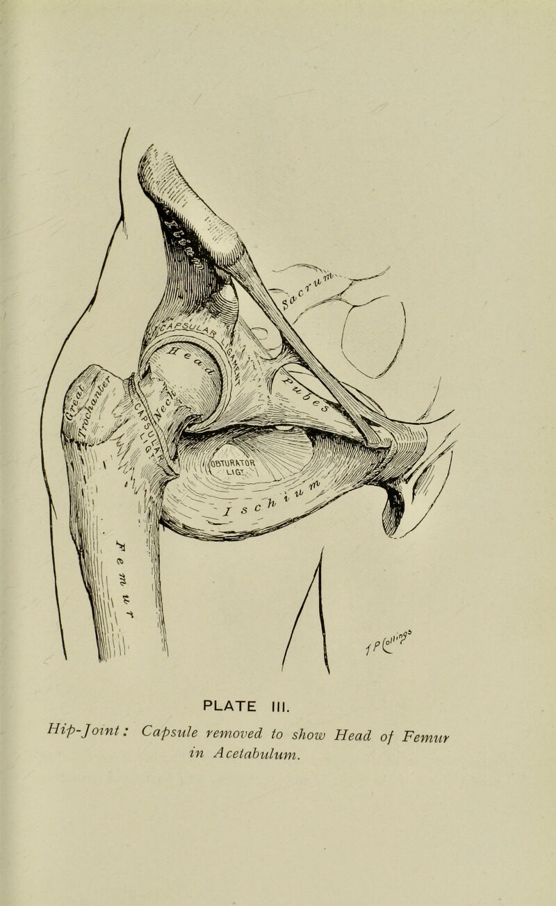 IPH Hip-Joint: Capsule removed, to show Head of Femur m Acetabulum. V\