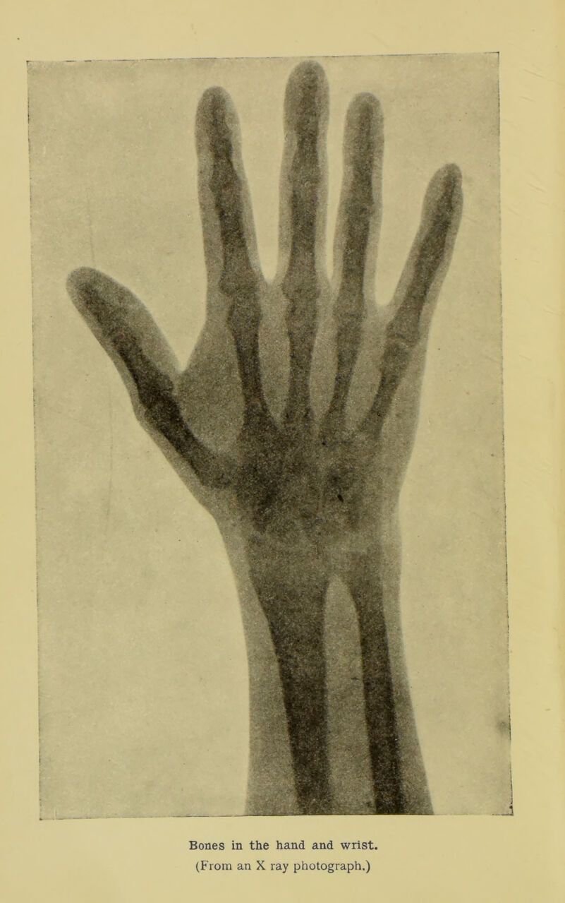 Bones in the hand and wrist, (From an X ray photograph.)