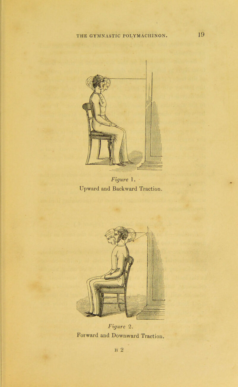 Figure 1. Upward and Backward Traction. Figure 2. Forward and Downward Traction.