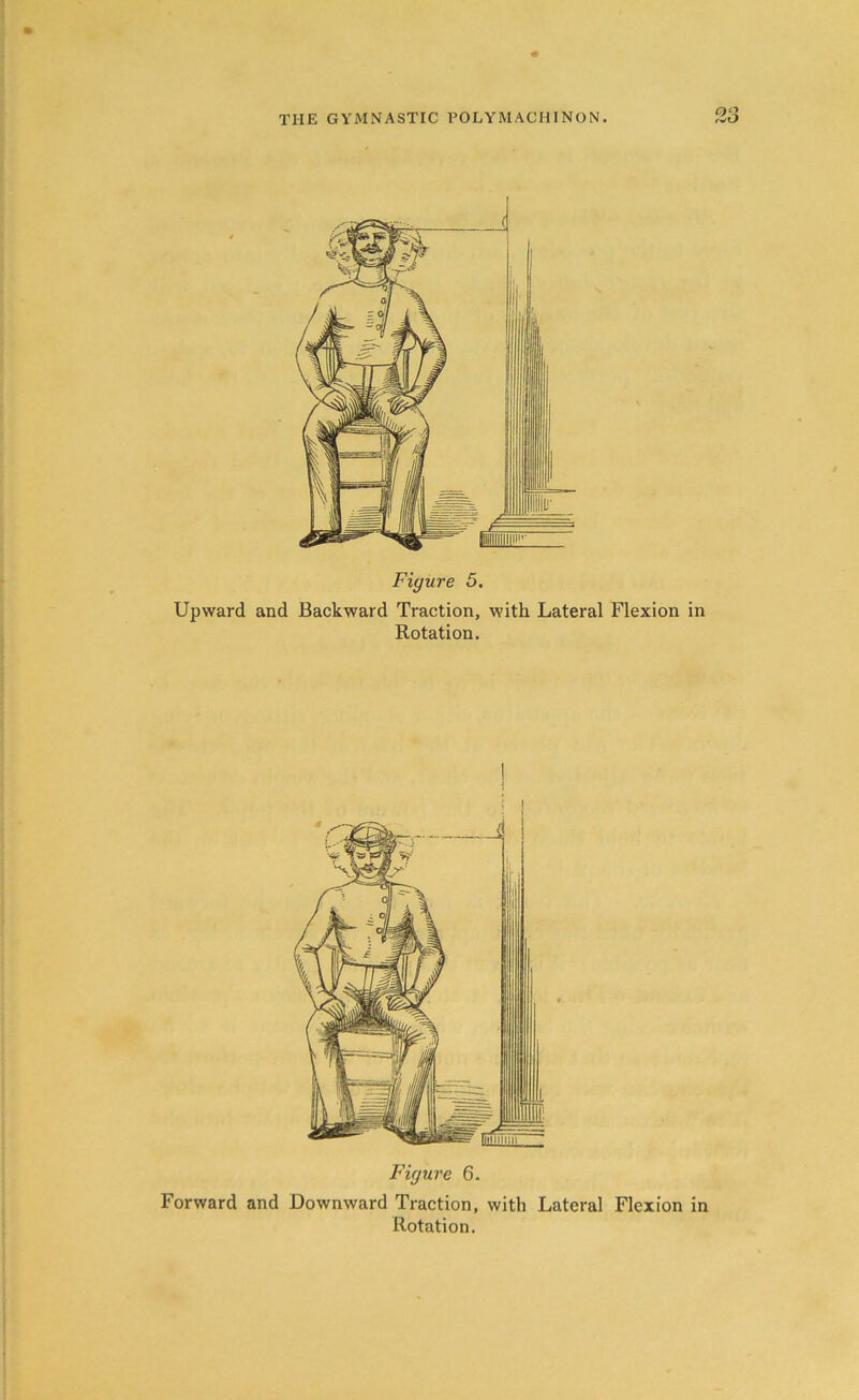 Figure 5. Upward and Backward Traction, with Lateral Flexion in Rotation. Figure 6. Forward and Downward Traction, with Lateral Flexion in Rotation.