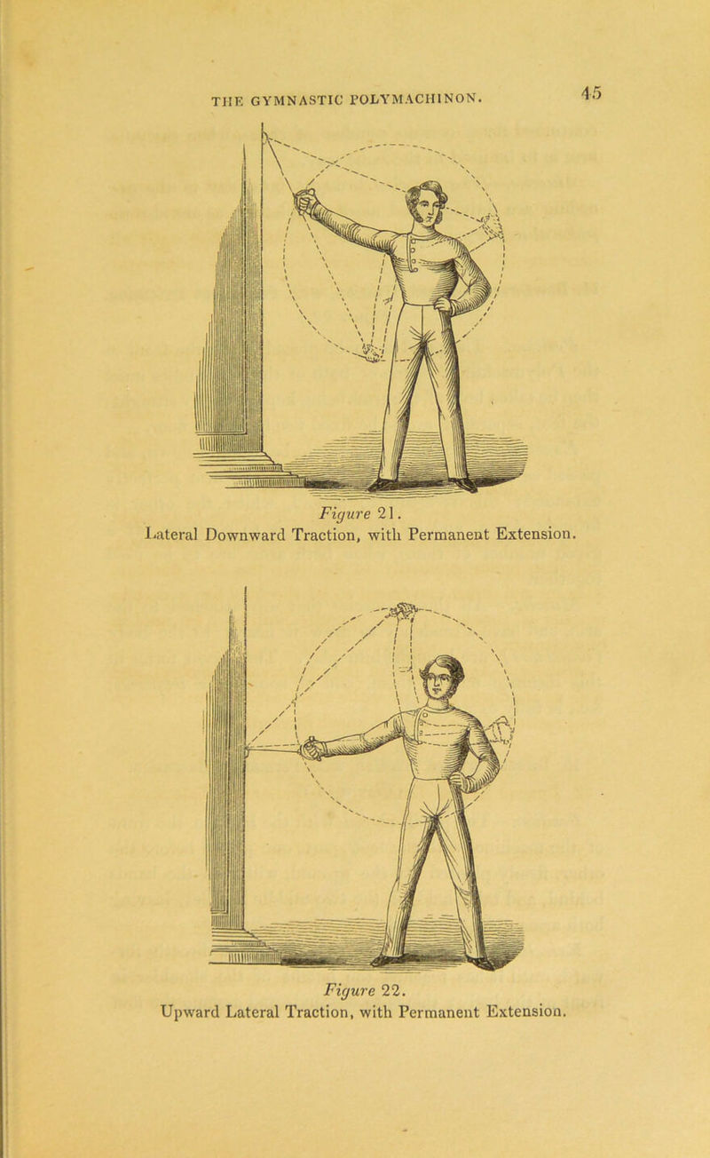 Figure 21. Lateral Downward Traction, with Permanent Extension. Figure 22. Upward Lateral Traction, with Permanent Extension