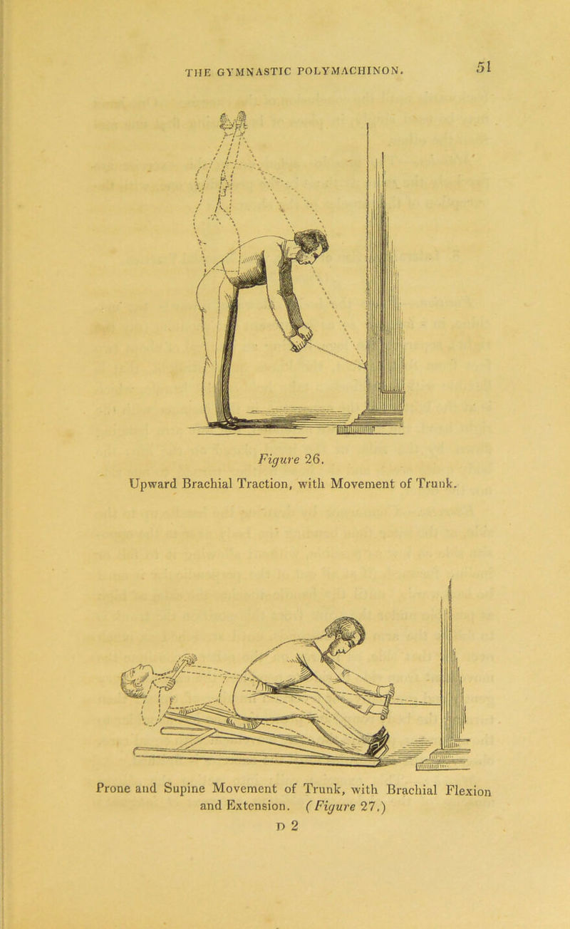 Figure 26. Upward Brachial Traction, with Movement of Trunk. Prone and Supine Movement of Trunk, with Brachial Flexion and Extension. (Figure 27.) D 2