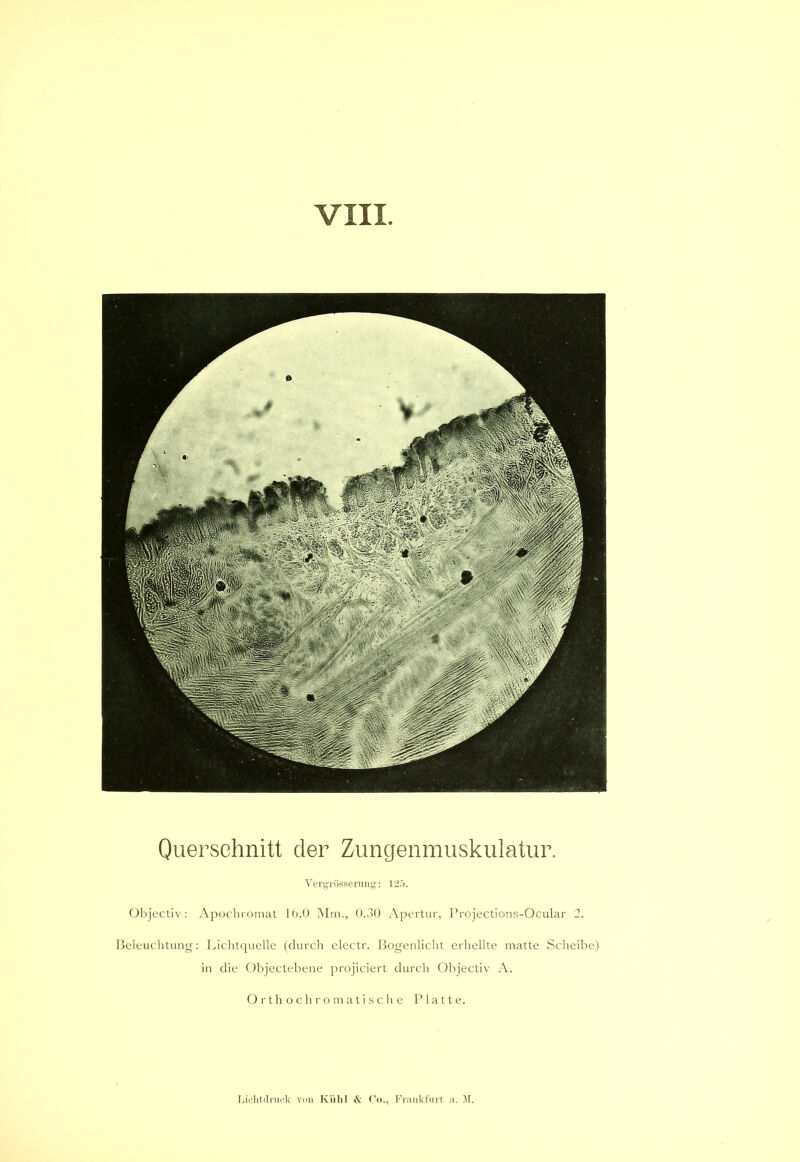 VIII Querschnitt der Zungenmuskulatur. Vergrösserung: 125. Objectiv: Apochromat 16.0 Mm., 0.30 Apertur, Projections-Ocular 2. Beleuchtung: Lichtquelle (durch electr. Bogenlicht erhellte matte Scheibe) in die Objectebene projiciert durch Objectiv A. Orthochromatische Platte.