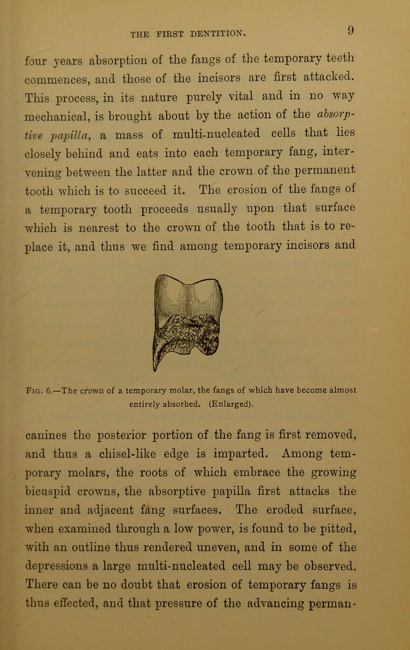 four years absorption of tlie fangs of tlie temporary teeth commences, and those of the incisors are first attacked. This process, in its nature purely vital and in no way mechanical, is brought about by the action of the absorp- tive papilla, a mass of multi-nucleated cells that lies closely behind and eats into each temporary fang, inter- vening between the latter and the crown of the permanent tooth which is to succeed it. The erosion of the fangs ol a temporary tooth proceeds usually upon that surface which is nearest to the crown of the tooth that is to re- place it, and thus we find among temporary incisors and Fig. 6.—The crown of a temporary molar, the fangs of which have become almost entirely absorbed. (Enlarged). canines the posterior portion of the fang is first removed, and thus a chisel-like edge is imparted. Among tem- porary molars, the roots of which embrace the growing bicuspid crowns, the absorptive papilla first attacks the inner and adjacent fang surfaces. The eroded surface, when examined through a low power, is found to be pitted, with an outline thus rendered uneven, and in some of the depressions a large multi-nucleated cell may be observed. There can be no doubt that erosion of temporary fangs is thus effected, and that pressure of the advancing perman-