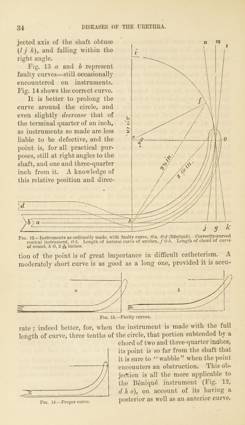 u jected axis of the shaft obtuse (l j h), and falling within the right angle. Fig. 13 a and b represent faulty curves—still occasionally encountered on instruments. Fig. 14 shows the correct curve. It is better to prolong the curve around the circle, and even slightly decrease that of the terminal quarter of an inch, as instruments so made are less liable to be defective, and the point is, for all practical pur- poses, still at right angles to the shaft, and one and three-quarter inch from it. A knowledge of this relative position and direc- Fig. 12.—Instruments as ordinarily made, with faulty curve, Oa, Od (Benique). Correctly-curved conical instrument, Ob. Length of natural curve of urethra,/ Oh. Length of chord oi curve of sound, h 0, 2 inches. tion of the point is of great importance in difficult catheterism. A moderately short curve is as good as a long one, provided it is accu- Fig. 13.—Faulty curves. rate ; indeed better, for, when the instrument is made with the full length of curve, three tenths of the circle, that portion subtended b\ a chord of two and three-quarter inches, its point is so far from the shaft that it is sure to “ wabble” when the point encounters an obstruction. This ob- jection is all the more applicable to the Benique instrument (Fig. 12, d h o), on account of its having a posterior as well as an anterior curve. Fig. 14.—Proper curve.