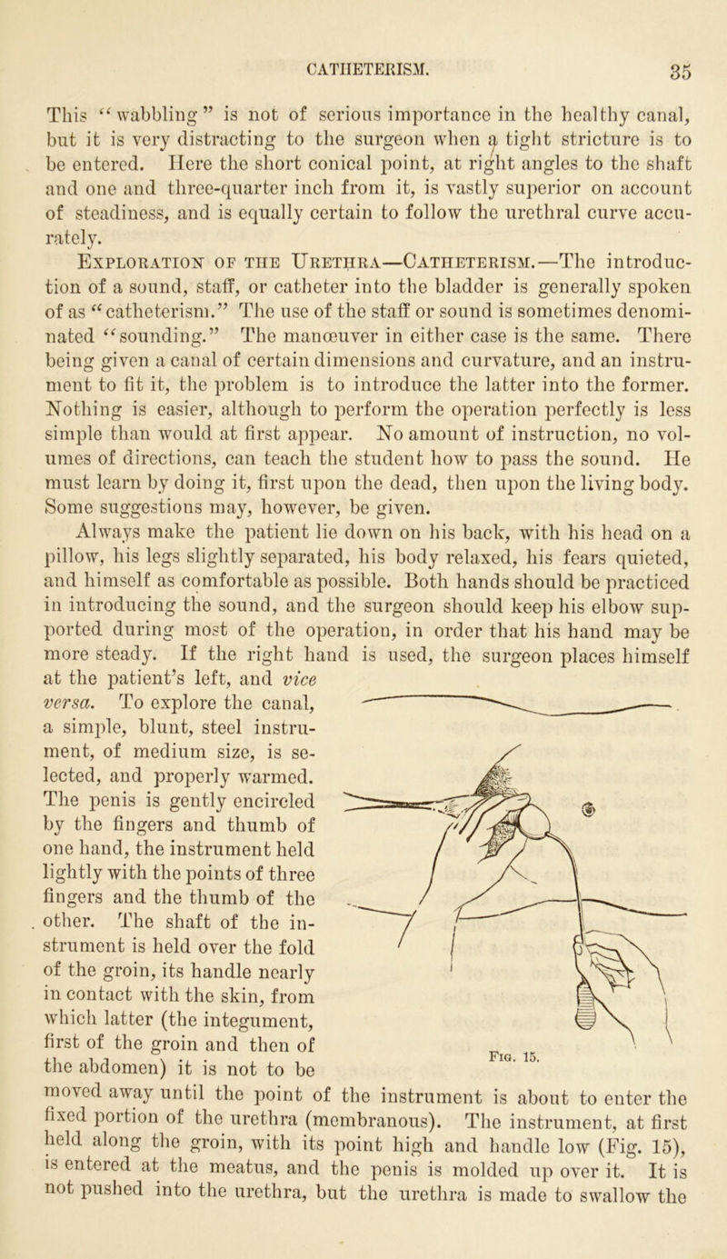 This “wabbling” is not of serious importance in the healthy canal, but it is very distracting to the surgeon when q tight stricture is to be entered. Here the short conical point, at right angles to the shaft and one and three-quarter inch from it, is vastly superior on account of steadiness, and is equally certain to follow the urethral curve accu- rately. Exploration of the Urethra—Catheterism.—The introduc- tion of a sound, staff, or catheter into the bladder is generally spoken of as “catheterism.” The use of the staff or sound is sometimes denomi- nated “sounding.” The manceuver in either case is the same. There being given a canal of certain dimensions and curvature, and an instru- ment to fit it, the problem is to introduce the latter into the former. Nothing is easier, although to perform the operation perfectly is less simple than would at first appear. No amount of instruction, no vol- umes of directions, can teach the student how to pass the sound. He must learn by doing it, first upon the dead, then upon the living body. Some suggestions may, however, be given. Always make the patient lie down on his back, with his head on a pillow, his legs slightly separated, his body relaxed, his fears quieted, and himself as comfortable as possible. Both hands should be practiced in introducing the sound, and the surgeon should keep his elbow sup- ported during most of the operation, in order that his hand may be more steady. If the right hand is used, the surgeon places himself at the patient’s left, and vice versa. To explore the canal, a simple, blunt, steel instru- ment, of medium size, is se- lected, and properly warmed. The penis is gently encircled by the fingers and thumb of one hand, the instrument held lightly with the points of three fingers and the thumb of the . other. The shaft of the in- strument is held over the fold of the groin, its handle nearly in contact with the skin, from which latter (the integument, first of the groin and then of the abdomen) it is not to be moved away until the point of the instrument is about to enter the fixed portion of the urethra (membranous). The instrument, at first held along the groin, with its point high and handle low (Fig. 15), is entered at the meatus, and the penis is molded up over it. It is not pushed into the urethra, but the urethra is made to swallow the