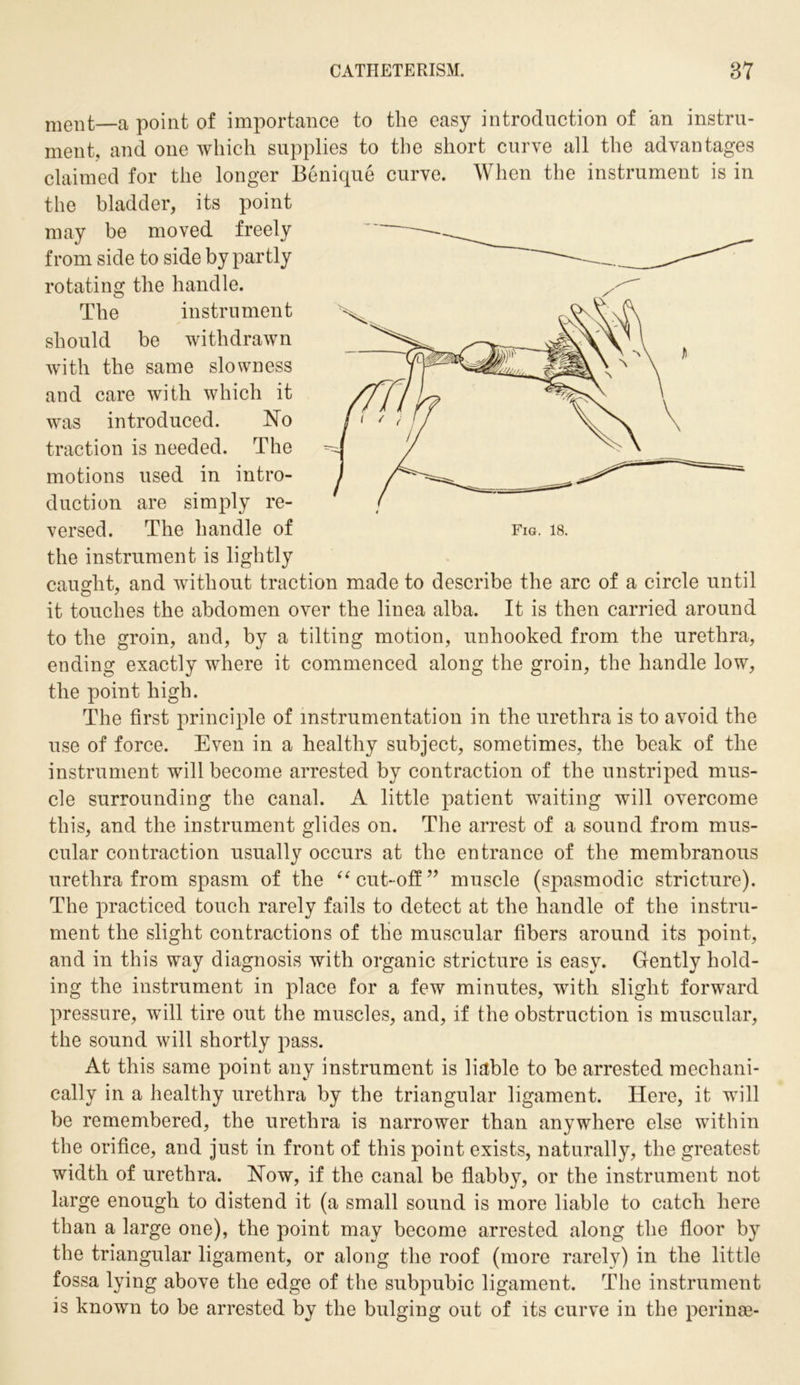 ment—a point of importance to the easy introduction of an instru- ment, and one which supplies to the short curve all the advantages claimed for the longer Benique curve. When the instrument is in the bladder, its point may be moved freely from side to side by partly rotating the handle. The instrument should be withdrawn with the same slowness and care with which it was introduced. No traction is needed. The motions used in intro- duction are simply re- versed. The handle of fig. is. the instrument is lightly caught, and without traction made to describe the arc of a circle until it touches the abdomen over the linea alba. It is then carried around to the groin, and, by a tilting motion, unhooked from the urethra, ending exactly where it commenced along the groin, the handle low, the point high. The first principle of instrumentation in the urethra is to avoid the use of force. Even in a healthy subject, sometimes, the beak of the instrument will become arrested by contraction of the unstriped mus- cle surrounding the canal. A little patient waiting will overcome this, and the instrument glides on. The arrest of a sound from mus- cular contraction usually occurs at the entrance of the membranous urethra from spasm of the “cut-off:” muscle (spasmodic stricture). The practiced touch rarely fails to detect at the handle of the instru- ment the slight contractions of the muscular fibers around its point, and in this way diagnosis with organic stricture is easy. Gently hold- ing the instrument in place for a few minutes, with slight forward pressure, will tire out the muscles, and, if the obstruction is muscular, the sound will shortly pass. At this same point any instrument is liable to be arrested mechani- cally in a healthy urethra by the triangular ligament. Here, it will be remembered, the urethra is narrower than anywhere else within the orifice, and just in front of this point exists, naturally, the greatest width of urethra. Now, if the canal be flabby, or the instrument not large enough to distend it (a small sound is more liable to catch here than a large one), the point may become arrested along the floor by the triangular ligament, or along the roof (more rarely) in the little fossa lying above the edge of the subpubic ligament. The instrument is known to be arrested by the bulging out of its curve in the perinae-