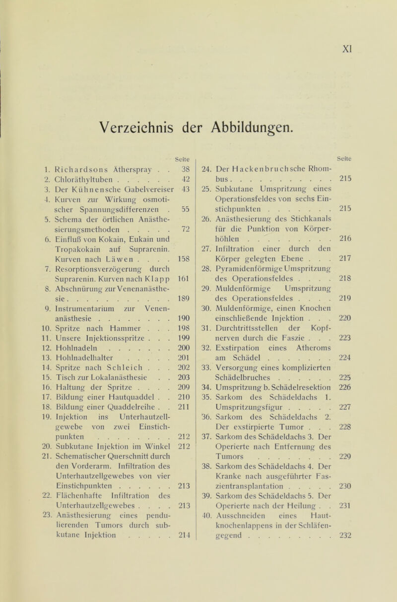Verzeichnis der Abbildungen. Seite 1. Richard so ns Ätherspray . . 38 2. Chloräthyltuben 42 3. Der Kühnensche Gabelvereiser 43 4. Kurven zur Wirkung osmoti- scher Spannungsdifferenzen . 55 5. Schema der örtlichen Anästhe- sierungsmethoden 72 6. Einfluß von Kokain, Eukain und Tropakokain auf Suprarenin. Kurven nach Läwen . . . . 158 7. Resorptionsverzögerung durch Suprarenin. Kurven nach Klapp 161 8. Abschnürung zur Venenanästhe- sie 189 9. Instrumentarium zur Venen- anästhesie 190 10. Spritze nach Hammer . . . 198 11. Unsere Injektionsspritze . . . 199 12. Hohlnadeln 200 13. Hohlnadelhalter 201 14. Spritze nach Schleich . . . 202 15. Tisch zur Lokalanästhesie . . 203 16. Haltung der Spritze .... 209 17. Bildung einer Hautquaddel . . 210 18. Bildung einer Quaddelreihe . . 211 19. Injektion ins Unterhautzell- gewebe von zwei Einstich- punkten 212 20. Subkutane Injektion im Winkel 212 21. Schematischer Querschnitt durch den Vorderarm. Infiltration des Unterhautzellgewebes von vier Einstichpnnkten 213 22. Flächenhafte Infiltration des Unterhautzellgewebes .... 213 23. Anästhesierung eines pendu- lierenden Tumors durch sub- kutane Injektion 214 Seite 24. Der Hackenbruchsehe Rhom- bus 215 25. Subkutane Umspritzung eines Operationsfeldes von sechs Ein- stichpunkten 215 26. Anästhesierung des Stichkanals für die Punktion von Körper- höhlen 216 27. Infiltration einer durch den Körper gelegten Ebene . . . 217 28. Pyramidenförmige Umspritzung des Operationsfeldes .... 218 29. Muldenförmige Umspritzung des Operationsfeldes .... 219 30. Muldenförmige, einen Knochen einschließende Injektion . . . 220 31. Durchtrittsstellen der Kopf- nerven durch die Faszie . . . 223 32. Exstirpation eines Atheroms am Schädel 224 33. Versorgung eines komplizierten Schädelbruches 225 34. Umspritzung b. Schädelresektion 226 35. Sarkom des Schädeldachs 1. Umspritzungsfigur 227 36. Sarkom des Schädeldachs 2. Der exstirpierte Tumor . . . 228 37. Sarkom des Schädeldachs 3. Der Operierte nach Entfernung des Tumors 229 38. Sarkom des Schädeldachs 4. Der Kranke nach ausgeführter Fas- zientransplantation 230 39. Sarkom des Schädeldachs 5. Der Operierte nach der Heilung . . 231 40. Ausschneiden eines Haut- knochenlappens in der Schläfen- gegend 232
