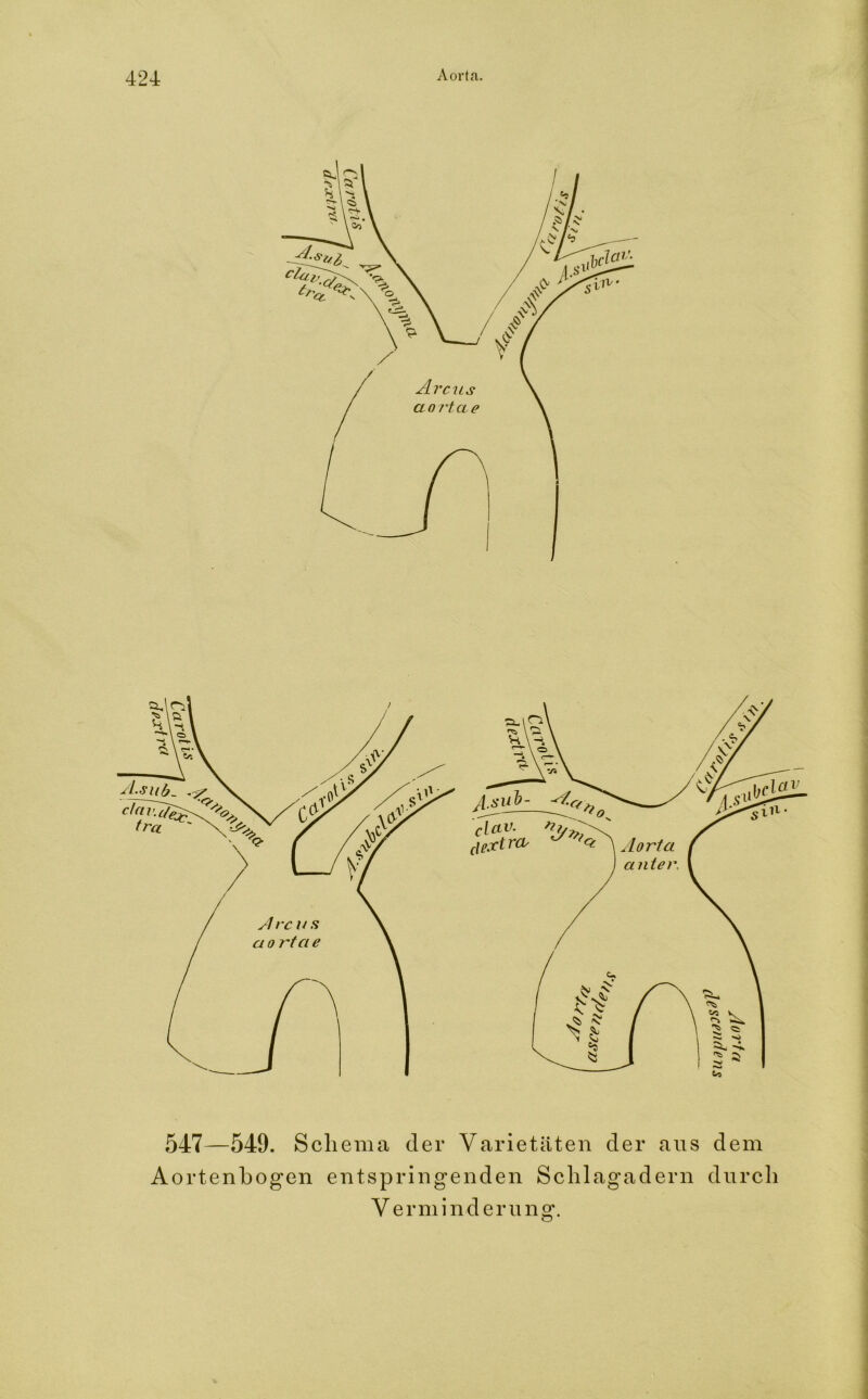 547—549. Schema der Varietäten der aus dem Aortenbogen entspringenden Schlagadern durch V erminderung.