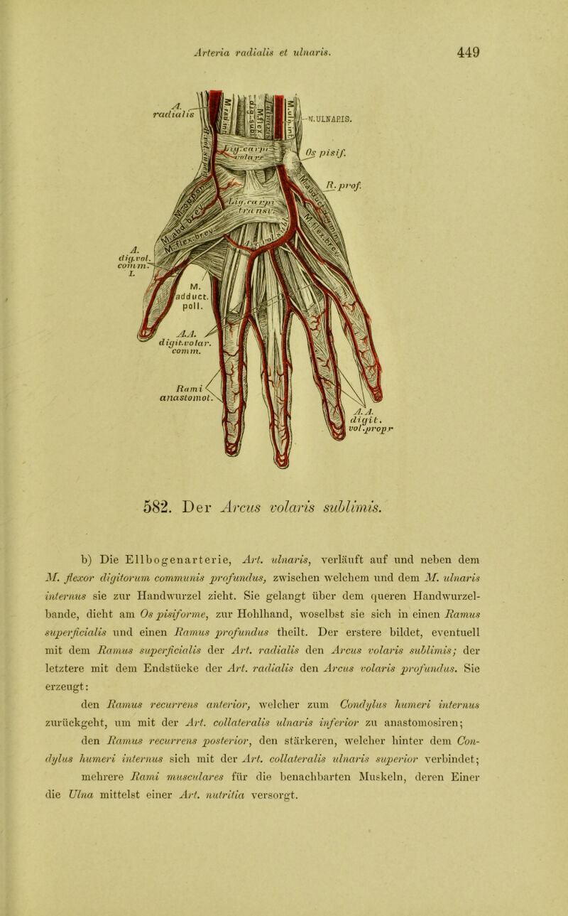 582. Der Arcus volaris sublimis. b) Die Ellbogenarterie, Art. ulnaris, verläuft auf und neben dem M. flexor digitorum communis profundus, zwischen welchem und dem M. ulnaris internus sie zur Handwurzel zieht. Sie gelangt über dem queren Handwurzel- bande, dicht am Os pisiforme, zur Hohlhand, woselbst sie sich in einen Ramus superficialis und einen Ramus profundus tlieilt. Der erstere bildet, eventuell mit dem Ramus superficialis der Art. radialis den Arcus volaris sublimis; der letztere mit dem Endstücke der Art. radialis den Arcus volaris profundus. Sie erzeugt: den Ramus recurrens anterior, welcher zum Condylus humeri internus zurückgeht, um mit der Art. collateralis ulnaris inferior zu anastomosiren; den Ramus recurrens posterior, den stärkeren, welcher hinter dem Con- dylus humeri internus sich mit der Art. collateralis idnaris superior verbindet; mehrere Rami musculares für die benachbarten Muskeln, deren Einer die Ulna mittelst einer Art. nutritia versorgt.