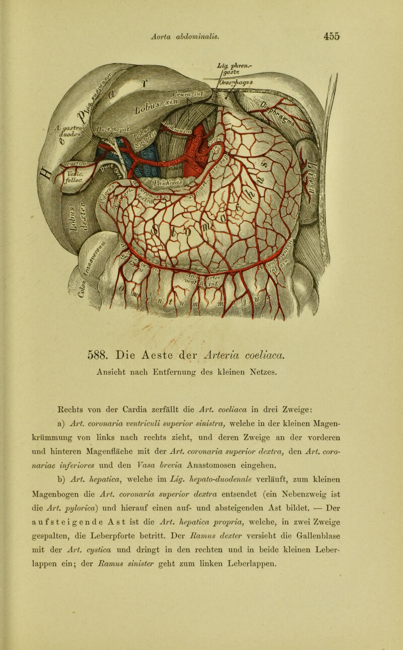 588. Die Aeste der Ärteria coeliaca. Ansicht nach Entfernung des kleinen Netzes. Rechts von der Cardia zerfällt die Art. coeliaca in drei Zweige: a) Art. coronaria ventriculi superior sinistra, welche in der kleinen Magen- krümmung von links nach rechts zieht, und deren Zweige an der vorderen und hinteren Magenfläche mit der Art. coronaria sujperior dextra, den Art. coro- nariae inferiores und den Vasa brevia Anastomosen eingehen. b) Art. hepatica, welche im Lig. hepato-duodenale verläuft, zum kleinen Magenbogen die Art. coronaria, sujperior dextra entsendet (ein Nebenzweig ist die Art. pylorica) und hierauf einen auf- und absteigenden Ast bildet. — Der aufsteigende Ast ist die Art. liepatica propria, welche, in zwei Zweige gespalten, die Leberpforte betritt. Der Ramus dexter versieht die Gallenblase mit der Art. cystica und dringt in den rechten und in beide kleinen Leber- lappen ein; der Ramus sinister geht zum linken Leberlappen.