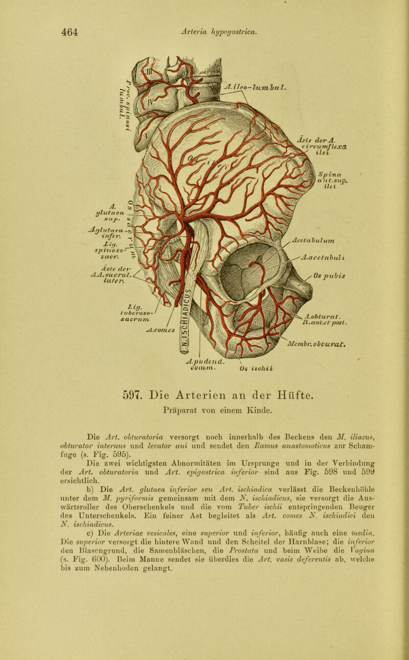 Aste der A. c i rcumflexa. ilet Sp i-n a a nt.sujp. ilci jt.ileo- 2u m hal. \ Os ischii Acebah ul um acctabuli Os pubis A. ce glutaccc S U. J). Ce -A.glutn eot infer. , jC I ff. spin'o sn - sacr. L ig. tubci'aso- sacnuii AL.comes sl.pudcnd. convm. A.obturat. R.anC.ct post. Membn obcurab. As/e der A.A, sacral. Later. 597. Die Arterien an der Hüfte. Präparat von einem Kinde. Die Art. obturatoria versorgt noch innerhalb des Bechens den M. iliacus, obturator internus und levator ani und sendet den Ramus anaslomoticus zur Scham- fuge (s. Fig. 595). Die zwei wichtigsten Abnormitäten im Ursprünge und in der Verbindung der Art. obturatoria und Art. epigastrica inferior sind aus Fig. 598 und 599 ersichtlich. b) Die Art. glutaea inferior seu Art. ischiadica verlässt die Beckenhöhle unter dem 31. pyriformis gemeinsam mit dem N. ischiadicus, sie versorgt die Aus- wärtsroller des Oberschenkels und die vom Tuber isclrii entspringenden Beuger des Unterschenkels. Ein feiner Ast begleitet als Art. comes N. ischiadici den AT. ischiadicus. c) Die Arteriae vesicales, eine superior und inferior, häufig auch eine media. Die superior versorgt die hintere Wand und den Scheitel der Harnblase; die inferior den Blasengrund, die Samenbläschen, die Prostata und beim Weibe die Vagina (s. Fig. 600). Beim Manne sendet sie überdies die Art. vasis deferentis ab, welche bis zum Nebenhoden gelangt.