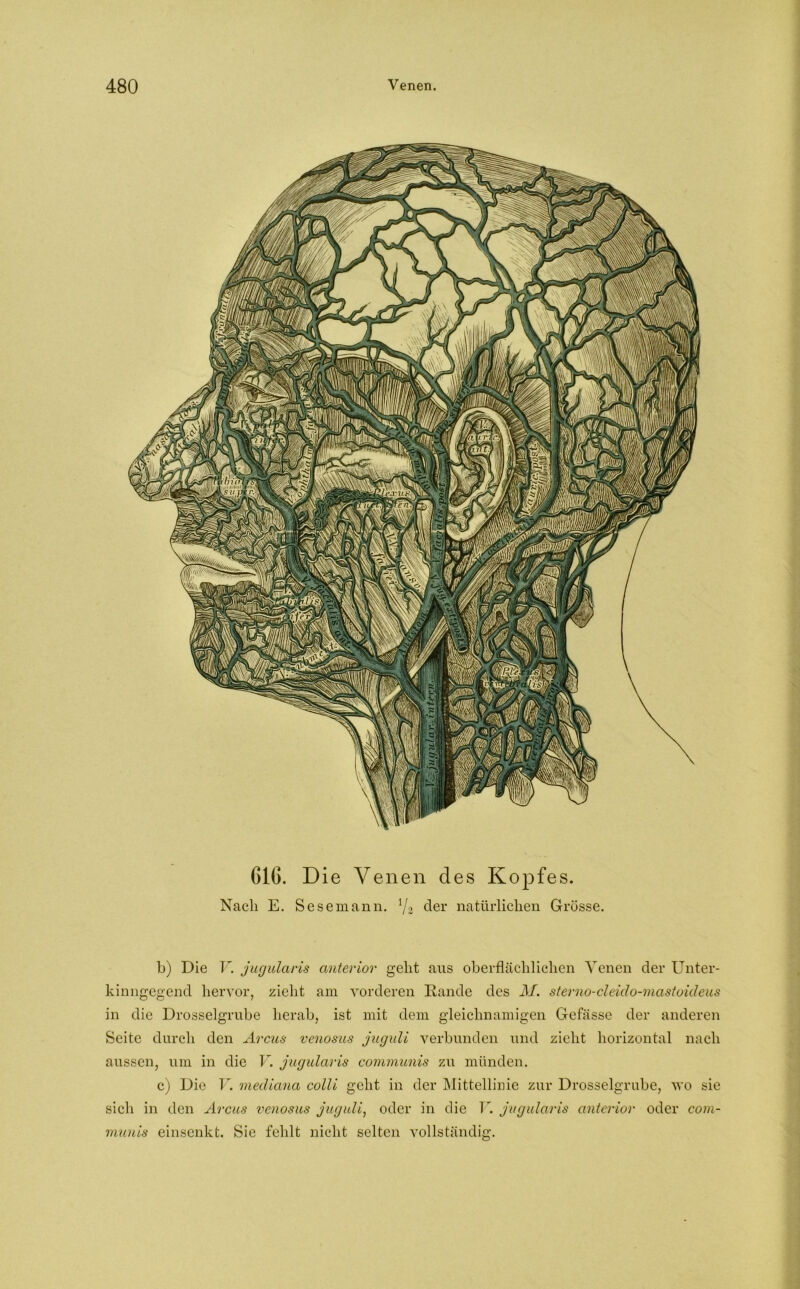 616. Die Venen cles Kopfes. Nach E. Sesemann. i/2 cler natürlichen Grösse. b) Die V. jugularis anterior geht aus oberflächlichen Venen der Unter- kinngegend hervor, zieht am vorderen Rande des M. sterno-cleido-mastoideus in die Drosselgrube herab, ist mit dem gleichnamigen Gefässe der anderen Seite durch den Arcus venosus juguli verbunden und zieht horizontal nach aussen, um in die V. jugularis communis zu münden. c) Die V. mediana colli geht in der Mittellinie zur Drosselgrube, wo sie sich in den Arcus venosus juguli, oder in die V. jugularis anterior oder com- munis einsenkt. Sie fehlt nicht selten vollständig.