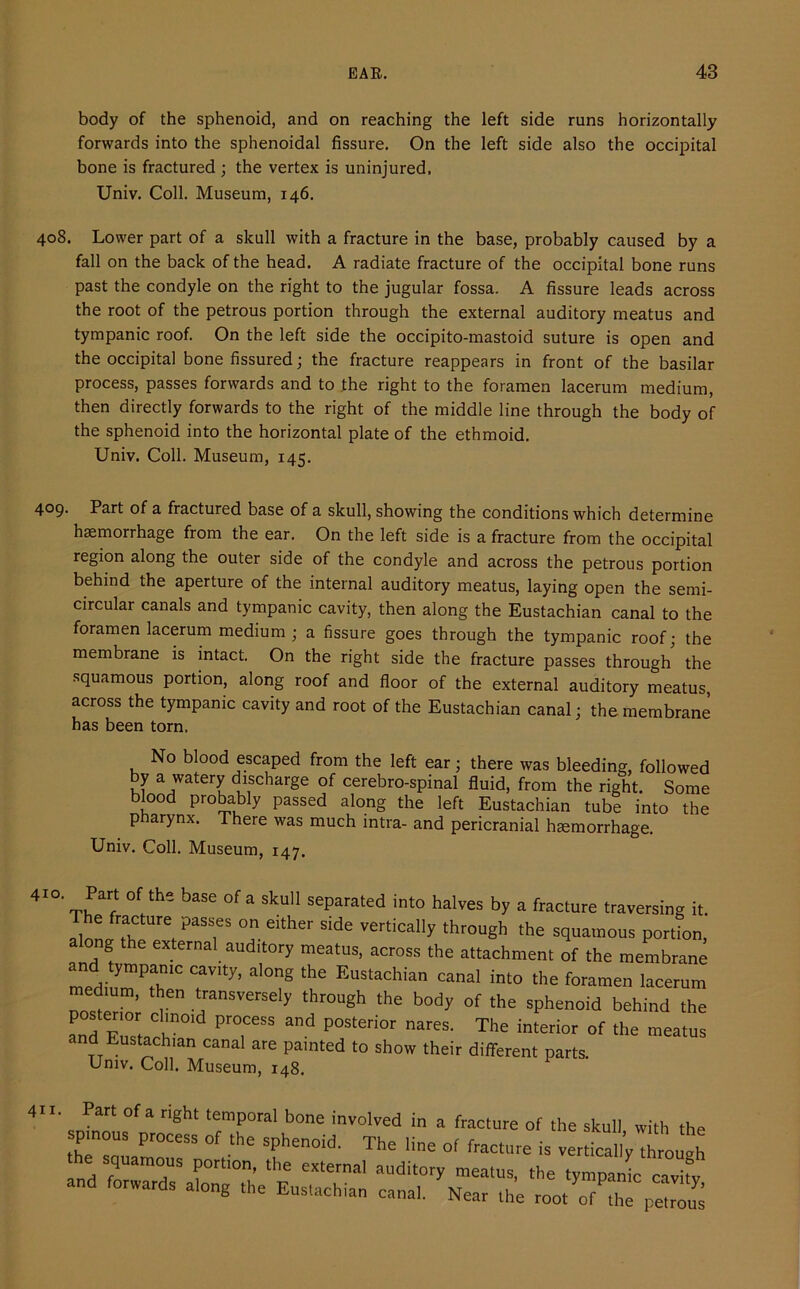 body of the sphenoid, and on reaching the left side runs horizontally forwards into the sphenoidal fissure. On the left side also the occipital bone is fractured ; the vertex is uninjured. Univ. Coll. Museum, 146. 408. Lower part of a skull with a fracture in the base, probably caused by a fall on the back of the head. A radiate fracture of the occipital bone runs past the condyle on the right to the jugular fossa. A fissure leads across the root of the petrous portion through the external auditory meatus and tympanic roof. On the left side the occipito-mastoid suture is open and the occipital bone fissured; the fracture reappears in front of the basilar process, passes forwards and to the right to the foramen lacerum medium, then directly forwards to the right of the middle line through the body of the sphenoid into the horizontal plate of the ethmoid. Univ. Coll. Museum, 145. 409. Part of a fractured base of a skull, showing the conditions which determine haemorrhage from the ear. On the left side is a fracture from the occipital region along the outer side of the condyle and across the petrous portion behind the aperture of the internal auditory meatus, laying open the semi- circular canals and tympanic cavity, then along the Eustachian canal to the foramen lacerum medium ; a fissure goes through the tympanic roof; the membrane is intact. On the right side the fracture passes through the squamous portion, along roof and floor of the external auditory meatus, across the tympanic cavity and root of the Eustachian canal; the membrane has been torn. No blood escaped from the left ear; there was bleeding, followed by a watery discharge of cerebro-spinal fluid, from the right. Some blood probably passed along the left Eustachian tube into the p arynx. There was much intra- and pericranial haemorrhage. Univ. Coll. Museum, 147. 410. Part of the base of a skull separated into halves by a fracture traversing it. The fracture passes on either side vertically through the squamous portion, ong the external auditory meatus, across the attachment of the membrane an ympamc cavity, along the Eustachian canal into the foramen lacerum nostnA v throu§h the body of the sphenoid behind the ^ PTSS and P°Steri0r nareS- The interior of the meatus and Eustachian canal are painted to show their different parts. Univ. Coll. Museum, 148. 411. Part of a right temporal bone involved in a fracture of the skull with the pmous process of the sphenoid. The line of fracture is vertiThroueh the squamous port,on, the external auditory meatus, the tympanic ctvify and forwards along the Eustachian canal. Near the root ofTp“r™