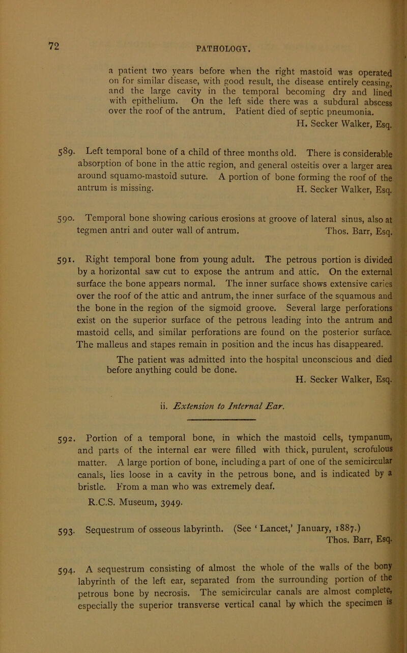 a patient two years before when the right mastoid was operated on for similar disease, with good result, the disease entirely ceasing, and the large cavity in the temporal becoming dry and lined with epithelium. On the left side there was a subdural abscess over the roof of the antrum. Patient died of septic pneumonia. H. Seeker Walker, Esq. 589. Left temporal bone of a child of three months old. There is considerable absorption of bone in the attic region, and general osteitis over a larger area around squamo-mastoid suture. A portion of bone forming the roof of the antrum is missing. H. Seeker Walker, Esq. 590. Temporal bone showing carious erosions at groove of lateral sinus, also at tegmen antri and outer wall of antrum. Thos. Barr, Esq. 591. Right temporal bone from young adult. The petrous portion is divided by a horizontal saw cut to expose the antrum and attic. On the external surface the bone appears normal. The inner surface shows extensive caries over the roof of the attic and antrum, the inner surface of the squamous and the bone in the region of the sigmoid groove. Several large perforations exist on the superior surface of the petrous leading into the antrum and mastoid cells, and similar perforations are found on the posterior surface. The malleus and stapes remain in position and the incus has disappeared. The patient was admitted into the hospital unconscious and died before anything could be done. H. Seeker Walker, Esq. ii. Extension to Internal Ear. 592. Portion of a temporal bone, in which the mastoid cells, tympanum, and parts of the internal ear were filled with thick, purulent, scrofulous matter. A large portion of bone, including a part of one of the semicircular canals, lies loose in a cavity in the petrous bone, and is indicated by a bristle. From a man who was extremely deaf. R.C.S. Museum, 3949. eg-?. Sequestrum of osseous labyrinth. (See ‘ Lancet,’ January, 1887.) Thos. Barr, Esq. 594. A sequestrum consisting of almost the whole of the walls of the bony labyrinth of the left ear, separated from the surrounding portion of the petrous bone by necrosis. The semicircular canals are almost complete, especially the superior transverse vertical canal l>y which the specimen is