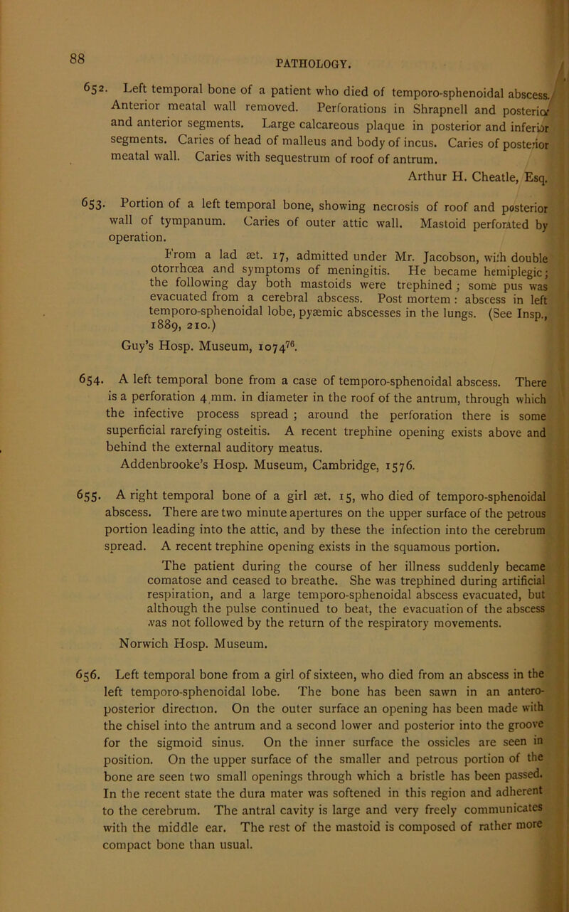PATHOLOGY. / i 652. Left temporal bone of a patient who died of temporo-sphenoidal abscess. Anterior meatal wall removed. Perforations in Shrapnell and posterior' and anterior segments. Large calcareous plaque in posterior and inferior segments. Caries of head of malleus and body of incus. Caries of posterior meatal wall. Caries with sequestrum of roof of antrum. Arthur H. Cheatle, Esq. 653- Portion of a left temporal bone, showing necrosis of roof and posterior wall of tympanum. Caries of outer attic wall. Mastoid perforated by operation. brom a lad tet. 17, admitted under Mr. Jacobson, wi:h double otorrhoea and symptoms of meningitis. He became hemiplegic; the following day both mastoids were trephined ; some pus was evacuated from a cerebral abscess. Post mortem : abscess in left temporo-sphenoidal lobe, pyasmic abscesses in the lungs. (See Insp., 1889, 210.) Guy’s Hosp. Museum, 107476. 654. A left temporal bone from a case of temporo-sphenoidal abscess. There is a perforation 4 mm. in diameter in the roof of the antrum, through which the infective process spread ; around the perforation there is some superficial rarefying osteitis. A recent trephine opening exists above and behind the external auditory meatus. Addenbrooke’s Hosp. Museum, Cambridge, 1576. 655. A right temporal bone of a girl set. 15, who died of temporo-sphenoidal abscess. There are two minute apertures on the upper surface of the petrous portion leading into the attic, and by these the infection into the cerebrum spread. A recent trephine opening exists in the squamous portion. The patient during the course of her illness suddenly became comatose and ceased to breathe. She was trephined during artificial respiration, and a large temporo-sphenoidal abscess evacuated, but although the pulse continued to beat, the evacuation of the abscess .vas not followed by the return of the respiratory movements. Norwich Hosp. Museum. 656. Left temporal bone from a girl of sixteen, who died from an abscess in the left temporo-sphenoidal lobe. The bone has been sawn in an antero- posterior direction. On the outer surface an opening has been made with the chisel into the antrum and a second lower and posterior into the groove for the sigmoid sinus. On the inner surface the ossicles are seen in position. On the upper surface of the smaller and petrous portion of the bone are seen two small openings through which a bristle has been passed. In the recent state the dura mater was softened in this region and adherent to the cerebrum. The antral cavity is large and very freely communicates with the middle ear. The rest of the mastoid is composed of rather more compact bone than usual.