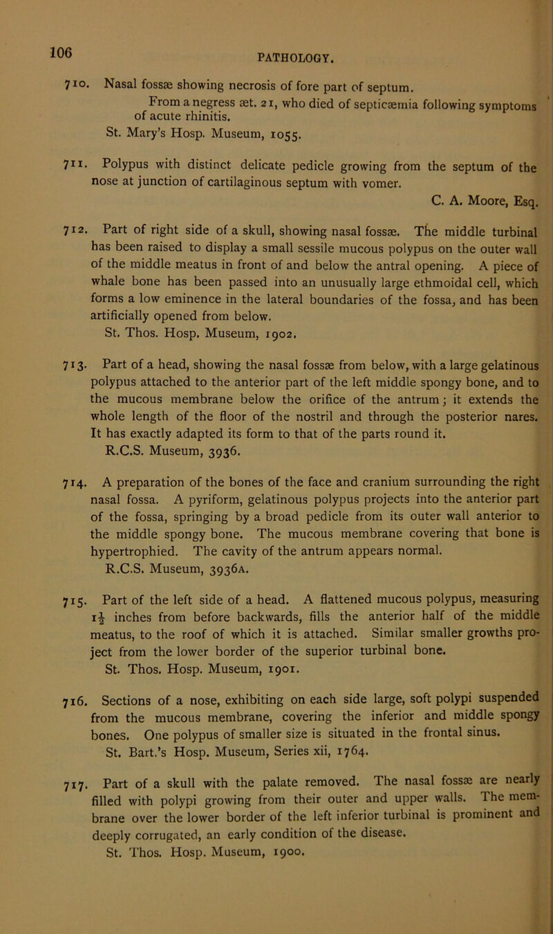 PATHOLOGY. 7 io. Nasal fossae showing necrosis of fore part of septum. Fromanegress aet. 21, who died of septicaemia following symptoms of acute rhinitis. St. Mary’s Hosp. Museum, 1055. 711. Polypus with distinct delicate pedicle growing from the septum of the nose at junction of cartilaginous septum with vomer. C. A. Moore, Esq. 712. Part of right side of a skull, showing nasal fossae. The middle turbinal has been raised to display a small sessile mucous polypus on the outer wall of the middle meatus in front of and below the antral opening. A piece of whale bone has been passed into an unusually large ethmoidal cell, which forms a low eminence in the lateral boundaries of the fossa, and has been artificially opened from below. St. Thos. Hosp. Museum, 1902. 713. Part of a head, showing the nasal fossae from below, with a large gelatinous polypus attached to the anterior part of the left middle spongy bone, and to the mucous membrane below the orifice of the antrum; it extends the whole length of the floor of the nostril and through the posterior nares. It has exactly adapted its form to that of the parts round it. R.C.S. Museum, 3936. 714. A preparation of the bones of the face and cranium surrounding the right nasal fossa. A pyriform, gelatinous polypus projects into the anterior part of the fossa, springing by a broad pedicle from its outer wall anterior to the middle spongy bone. The mucous membrane covering that bone is hypertrophied. The cavity of the antrum appears normal. R.C.S. Museum, 3936A. 715. Part of the left side of a head. A flattened mucous polypus, measuring inches from before backwards, fills the anterior half of the middle meatus, to the roof of which it is attached. Similar smaller growths pro- ject from the lower border of the superior turbinal bone. St. Thos. Hosp. Museum, 1901. 716. Sections of a nose, exhibiting on each side large, soft polypi suspended from the mucous membrane, covering the inferior and middle spongy bones. One polypus of smaller size is situated in the frontal sinus. St. Bart.’s Hosp. Museum, Series xii, 1764. 717. Part of a skull with the palate removed. The nasal fossae are nearly filled with polypi growing from their outer and upper walls. The mem- brane over the lower border of the left inferior turbinal is prominent and deeply corrugated, an early condition of the disease. St. Thos. Hosp. Museum, 1900.
