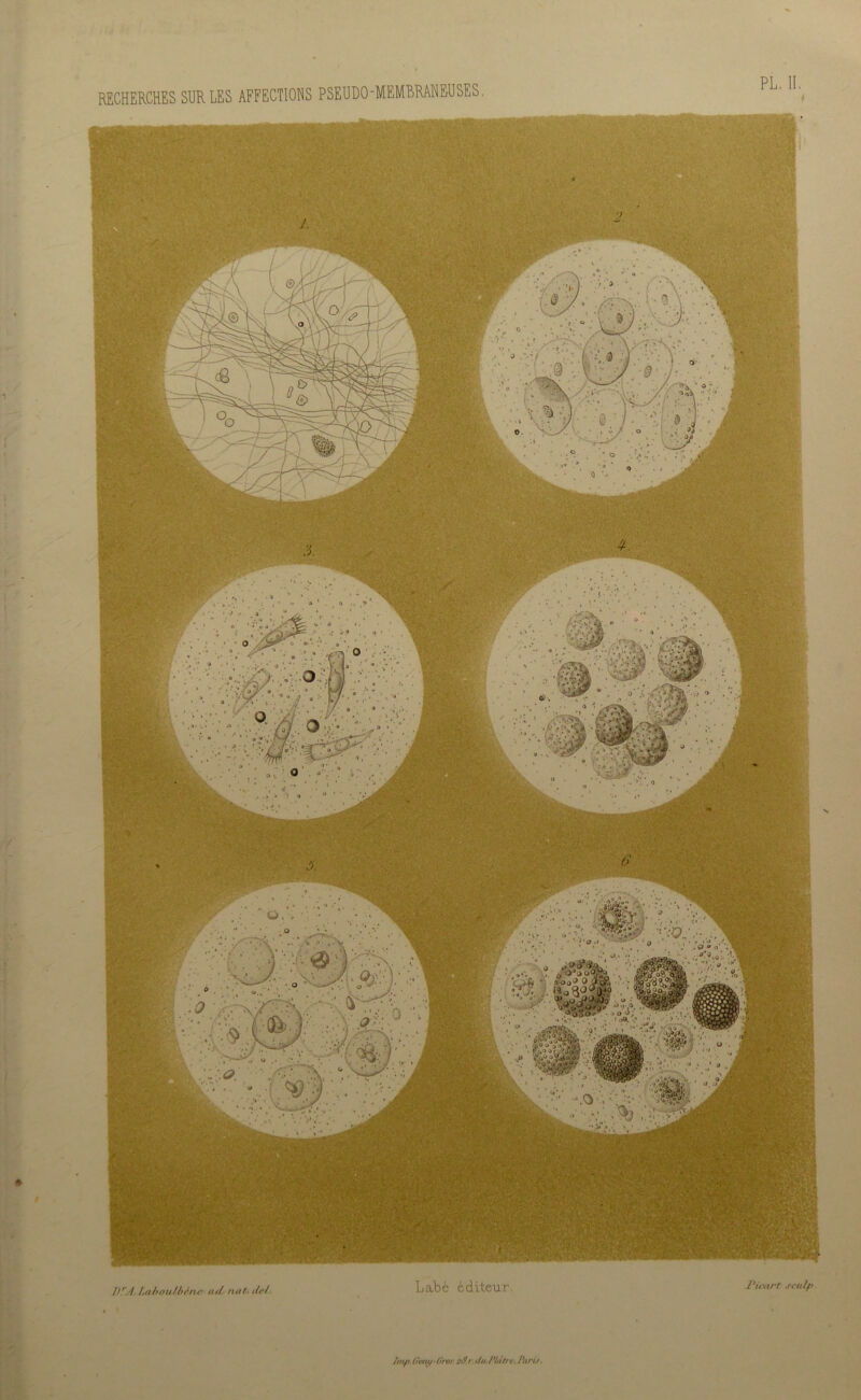 ■1 s I)rA. Inhou/bànc axt rutA tlri. L C C dit6U P, l'ù'art scalp RECHERCHES SUR LES AFFECTIONS PSEUDO-MEMBRANEUSES. ///y».Gnny-OroF.oS.r. t/u P/àt/Y, Paris.