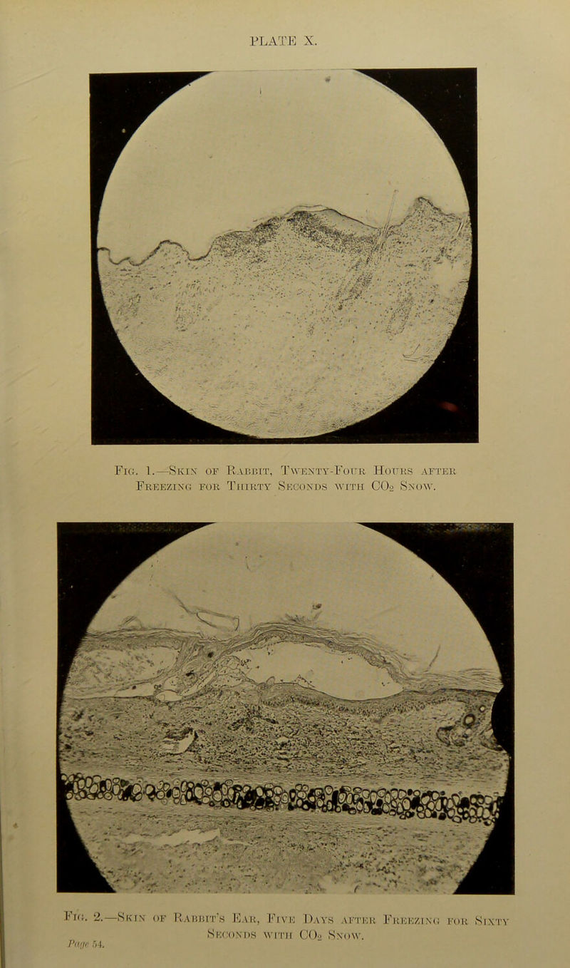 Fig. 1.—Skin of PvAcjiit, Twexty-Fotjb Freezing for TiriRTY Seconds with Hours after CO2 SNO^Y. Fkj. 2.—Skfn of Rariut'.s JCar, Five D.ays after Freezing for Sixty Se(;oni)S with CO2 Snow. I’li.iie .)4.