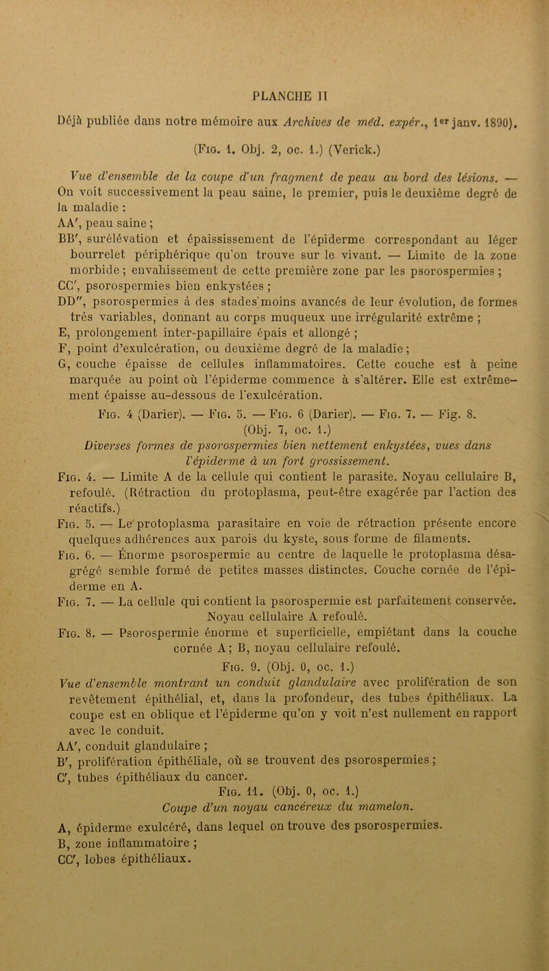 Déjà publiée dans notre mémoire aux Archives de méd, expêr,^ 1er janv. i890). (Fig. 1. Obj. 2, oc. 1.) (Verick.) Vue d'ensemble de la coupe d’un fragment de peau au bord des lésions. — On voit successivement la peau saine, le premier, puis le deuxième degré de la maladie : AA', peau saine ; BB', surélévation et épaississement de l’épiderme correspondant au léger bourrelet périphérique qu’on trouve sur le vivant. — Limite de la zone morbide ; envabissement de cette première zone par les psorospermies ; CC', psorospermies bien enkystées ; DD, psorospermies à des stades'moins avancés de leur évolution, de formes très variables, donnant au corps muqueux une irrégularité extrême ; E, prolongement inter-papillaire épais et allongé ; F, point d’exulcération, ou deuxième degré de la maladie ; G, coucbe épaisse de cellules inflammatoires. Cette coucbe est à peine marquée au point où l’épiderme commence à s’altérer. Elle est extrême- ment épaisse au-dessous de l'exulcération. Fig. 4 (Darier). — Fig. 5. — Fig. 6 (Darier). — Fig. 7. — Fig. 8. (Obj. 7, oc. 1.) Diverses formes de psorospermies bien nettement enkystées, vues dans l'épiderme à un fort grossissement. Fig. 4. — Limite A de la cellule qui contient le parasite. Noyau cellulaire B, refoulé. (Rétraction du protoplasma, peut-être exagérée par l’action des réactifs.) Fig. s. —7 Le protoplasma parasitaire en voie de rétraction présente encore quelques adhérences aux parois du kyste, sous forme de filaments. Fig. 6. — Énorme psorospermie au centre de laquelle le protoplasma désa- grégé semble formé de petites masses distinctes. Couche cornée de l’épi- derme en A. Fig. 7. — La cellule qui contient la psorospermie est parfaitement conservée. Noyau cellulaire A refoulé. Fio. 8. — Psorospermie énorme et superficielle, empiétant dans la couche cornée A; B, noyau cellulaire refoulé. Fig. 9. (Obj. 0, oc. 1.) Vue d'ensemble montrant un conduit glandulaire avec prolifération de son revêtement épithélial, et, dans la profondeur, des tubes épitbébaux. La coupe est en oblique et l’épiderme qu’on y voit n’est nullement eu rapport avec le conduit. AA', conduit glandulaire ; B', prolifération épithéliale, où se trouvent des psorospermies ; C', tubes épithéliaux du cancer. Fig. 11. (Obj. 0, oc. 1.) Coupe d’un noyau cancéreux du mamelon. A, épiderme exulcéré, dans lequel on trouve des psorospermies. B, zone inflammatoire ; CC', lobes épithéliaux.