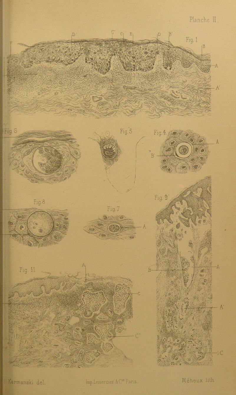 KarmansKi del. Impi.pnu.Tcicr /h