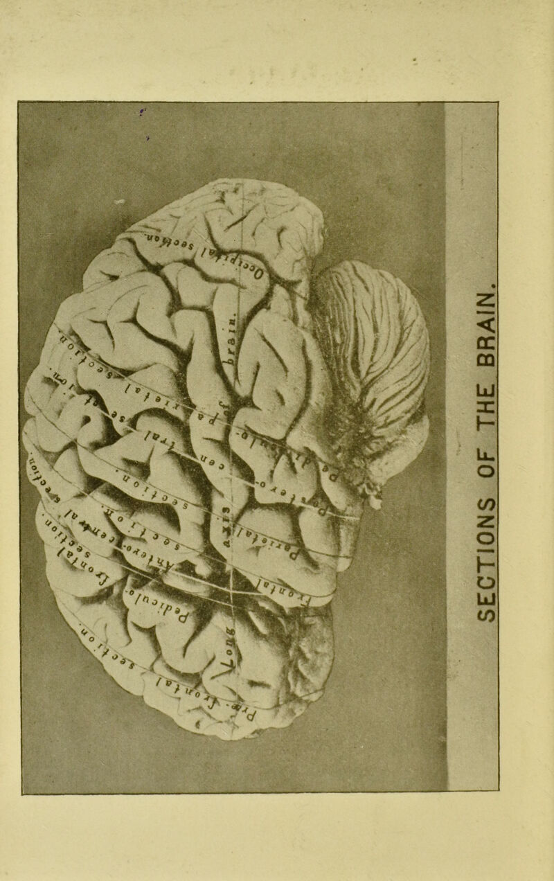 SECTIONS OF THE BRAIN.
