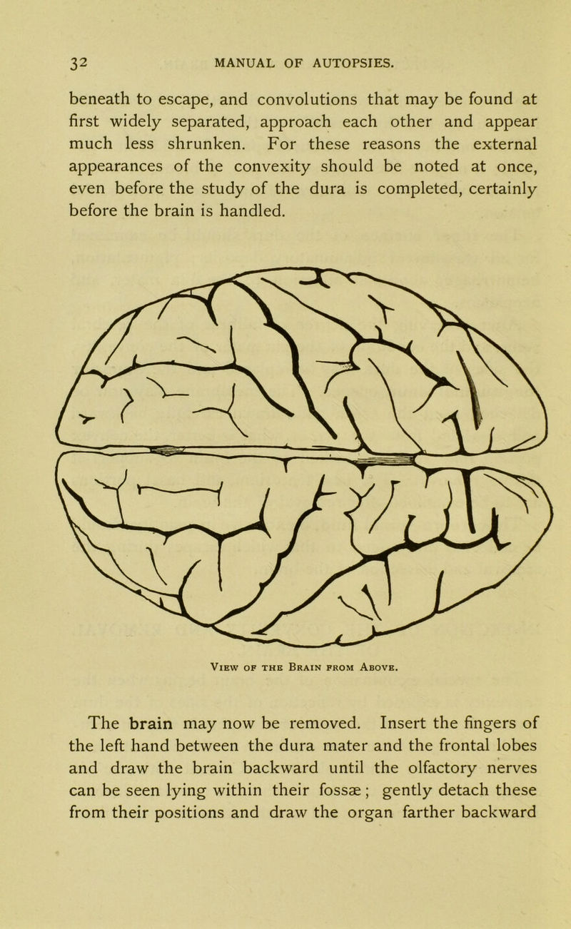 beneath to escape, and convolutions that may be found at first widely separated, approach each other and appear much less shrunken. For these reasons the external appearances of the convexity should be noted at once, even before the study of the dura is completed, certainly before the brain is handled. View of the Brain from Above. The brain may now be removed. Insert the fingers of the left hand between the dura mater and the frontal lobes and draw the brain backward until the olfactory nerves can be seen lying within their fossae ; gently detach these from their positions and draw the organ farther backward