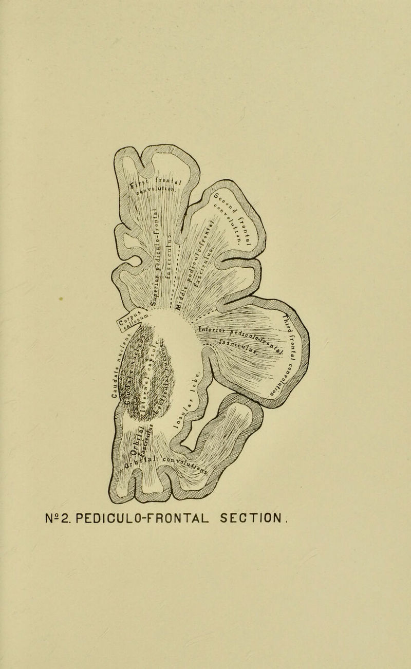 Ns2. PEDICULO-FRONTAL SECTION.