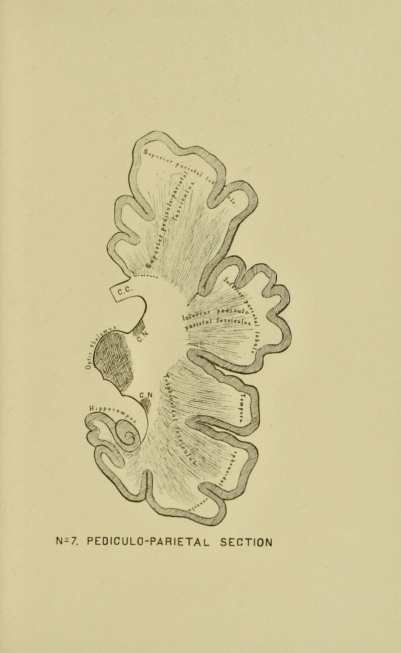 5 N-7. PEDICULO-PARIETAL SECTION
